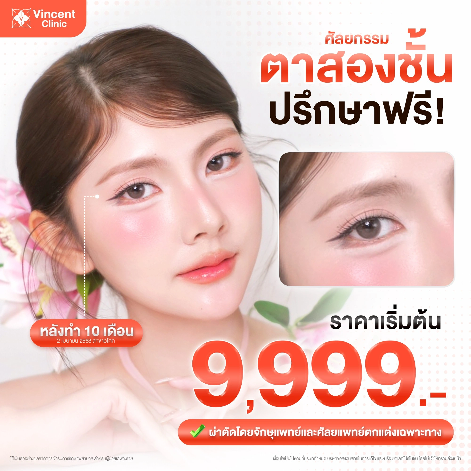 Double-Eyelids-9999.-