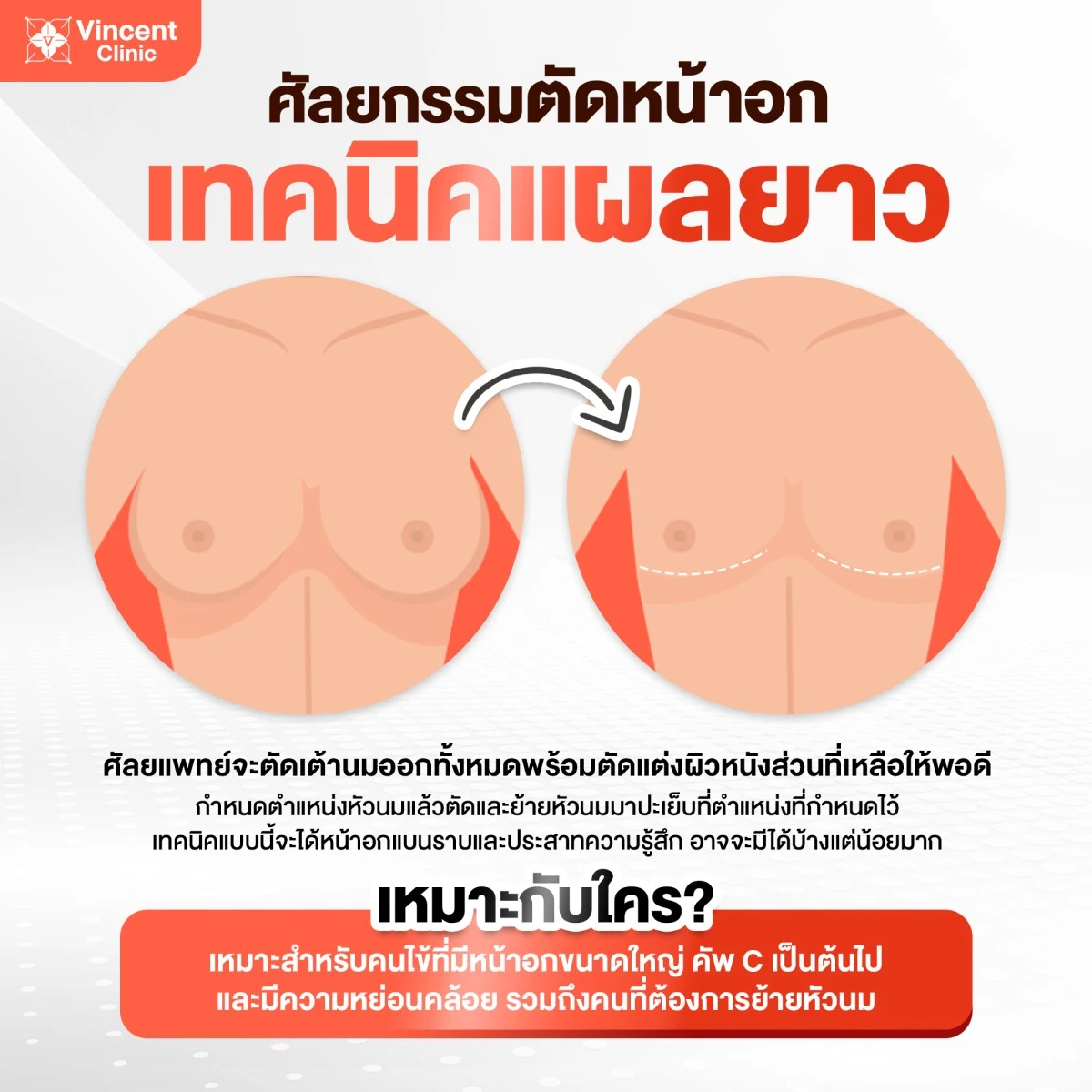ตัดหน้าอก3
