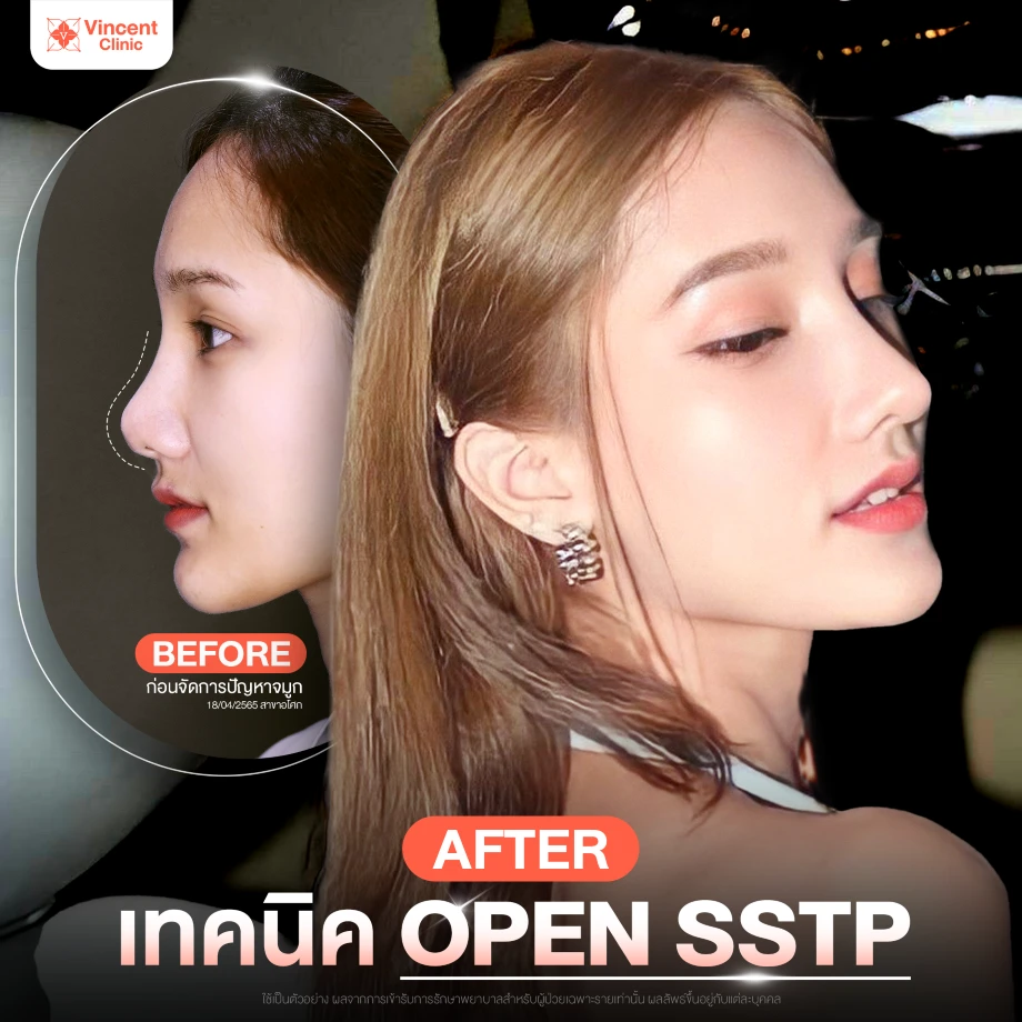 รูปรีวิว