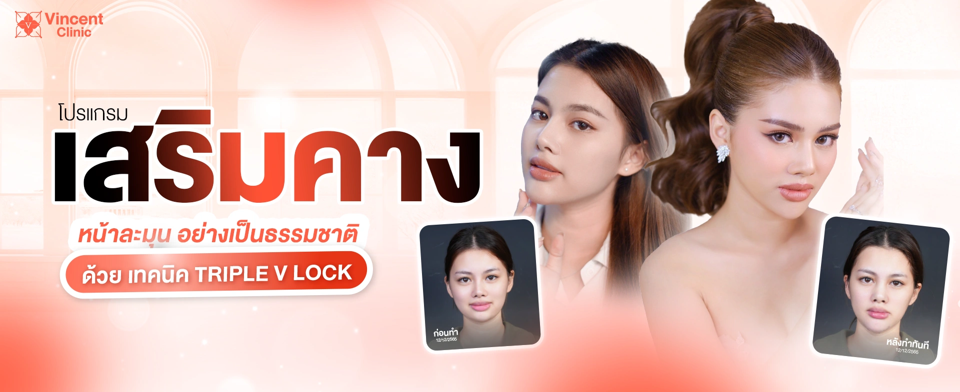 แบนเนอร์เสริมคาง pc