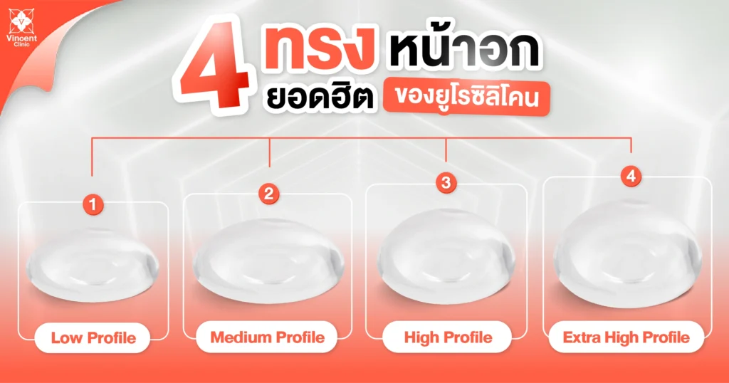 4 ทรงหน้าอกยอดฮิตของยูโรซิลิโคน
