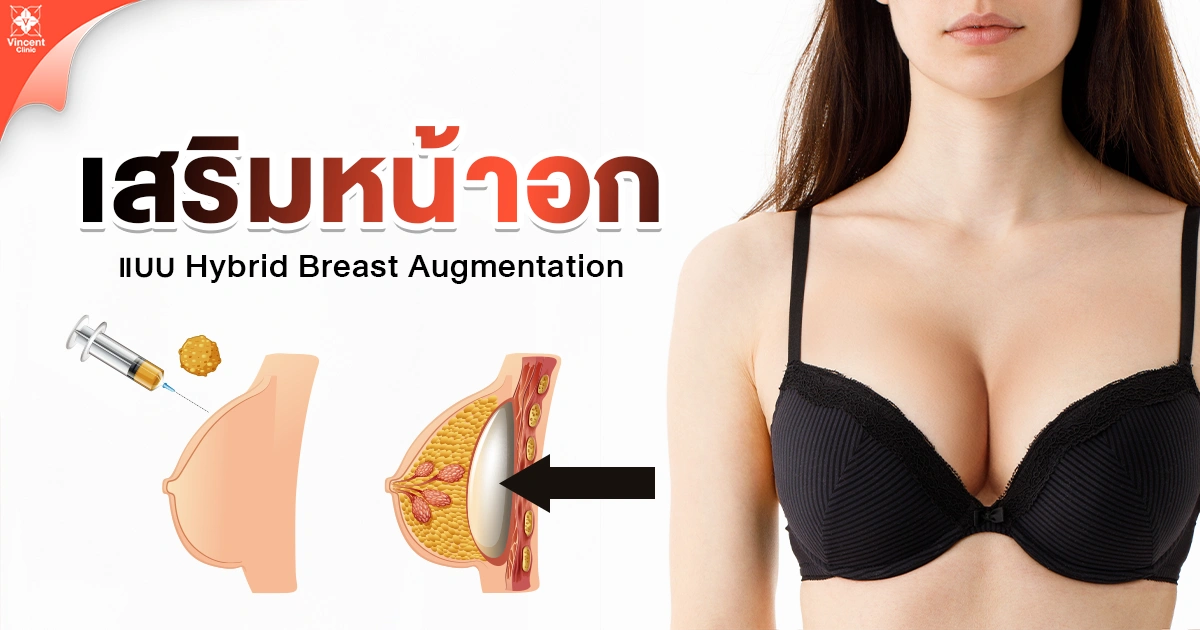 เสริมหน้าอกแบบ Hybrid Breast Augmentation