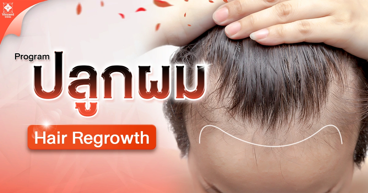 โปรแกรมปลูกผม