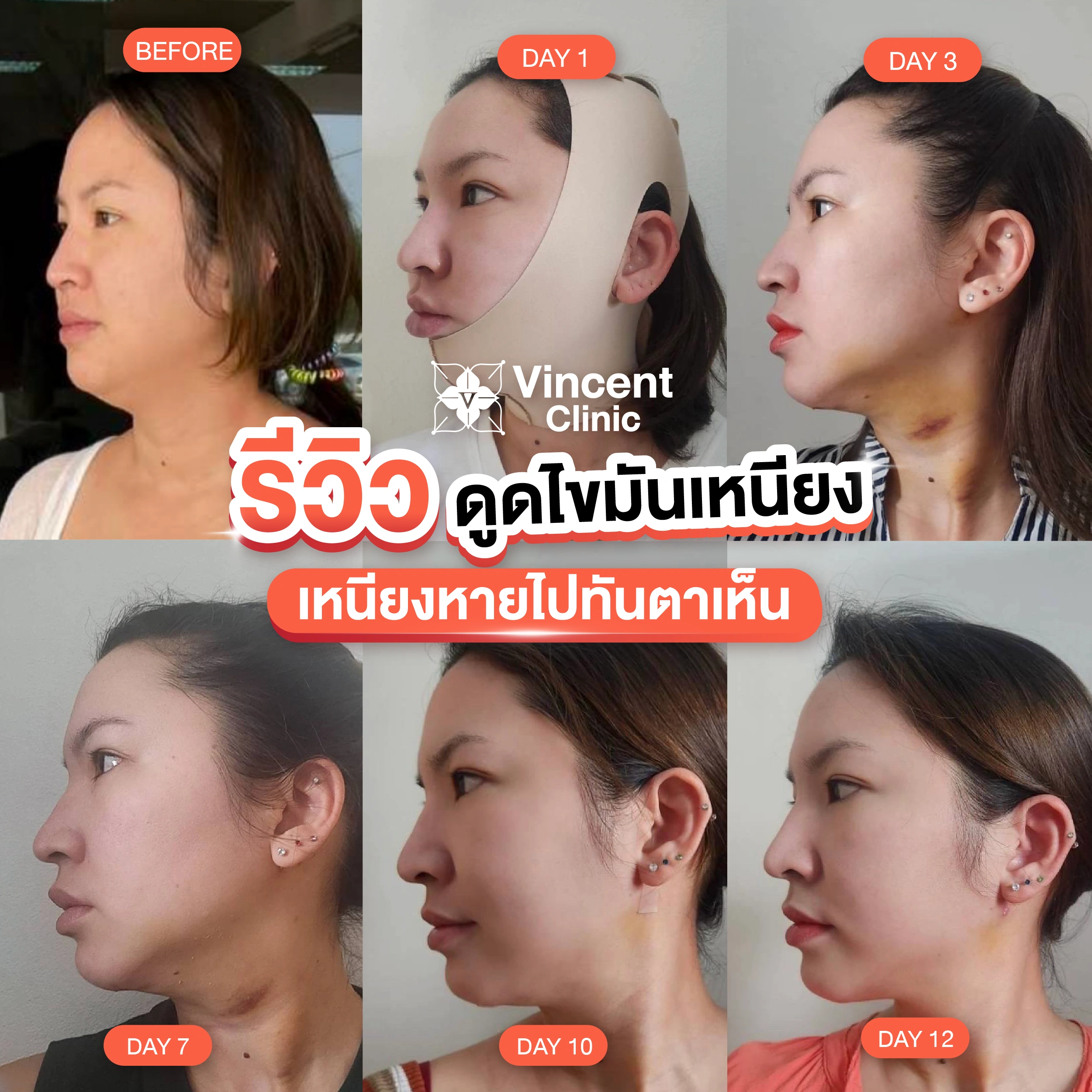 รูปรีวิว