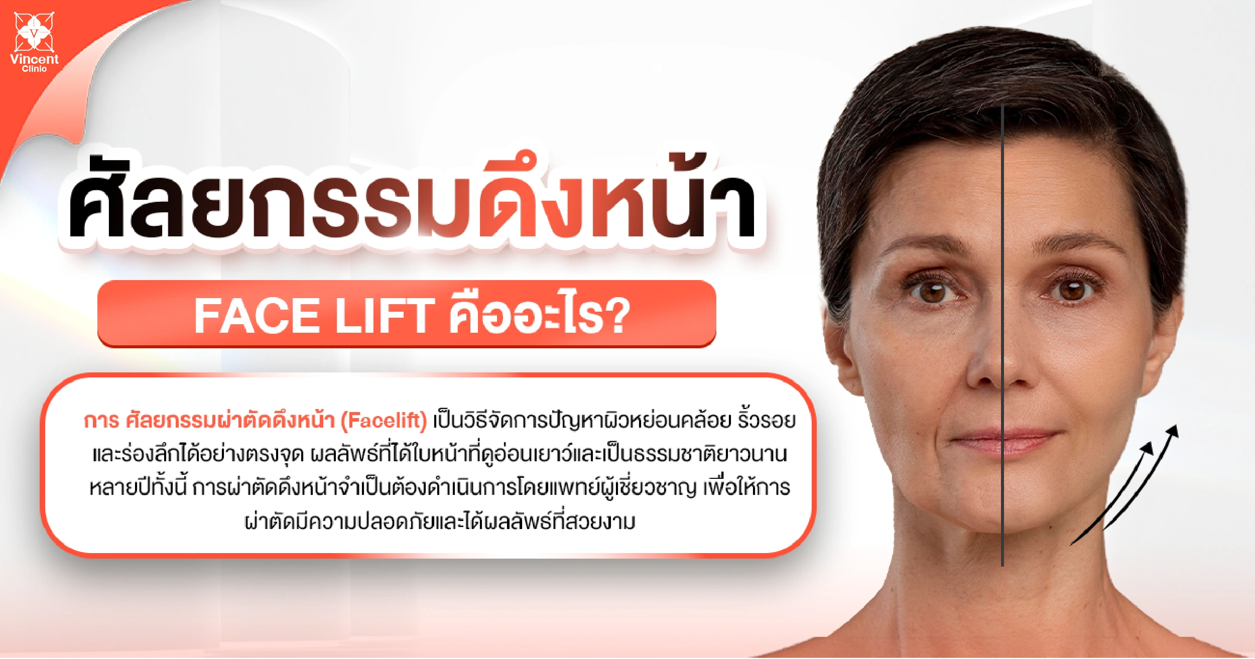 ศัลยกรรมดึงหน้าคืออะไร