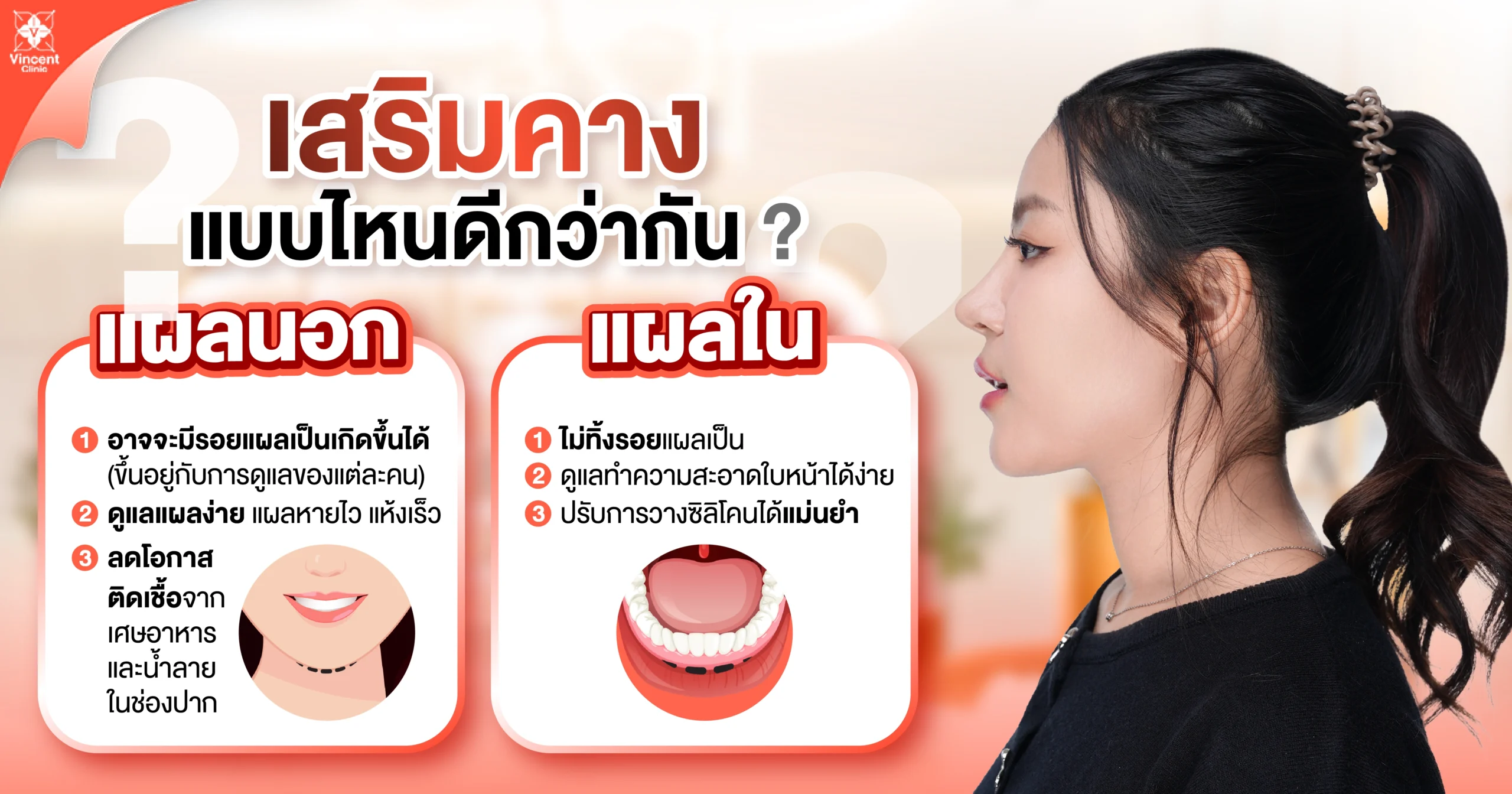 เสริมคางแบบไหนดีกว่ากัน