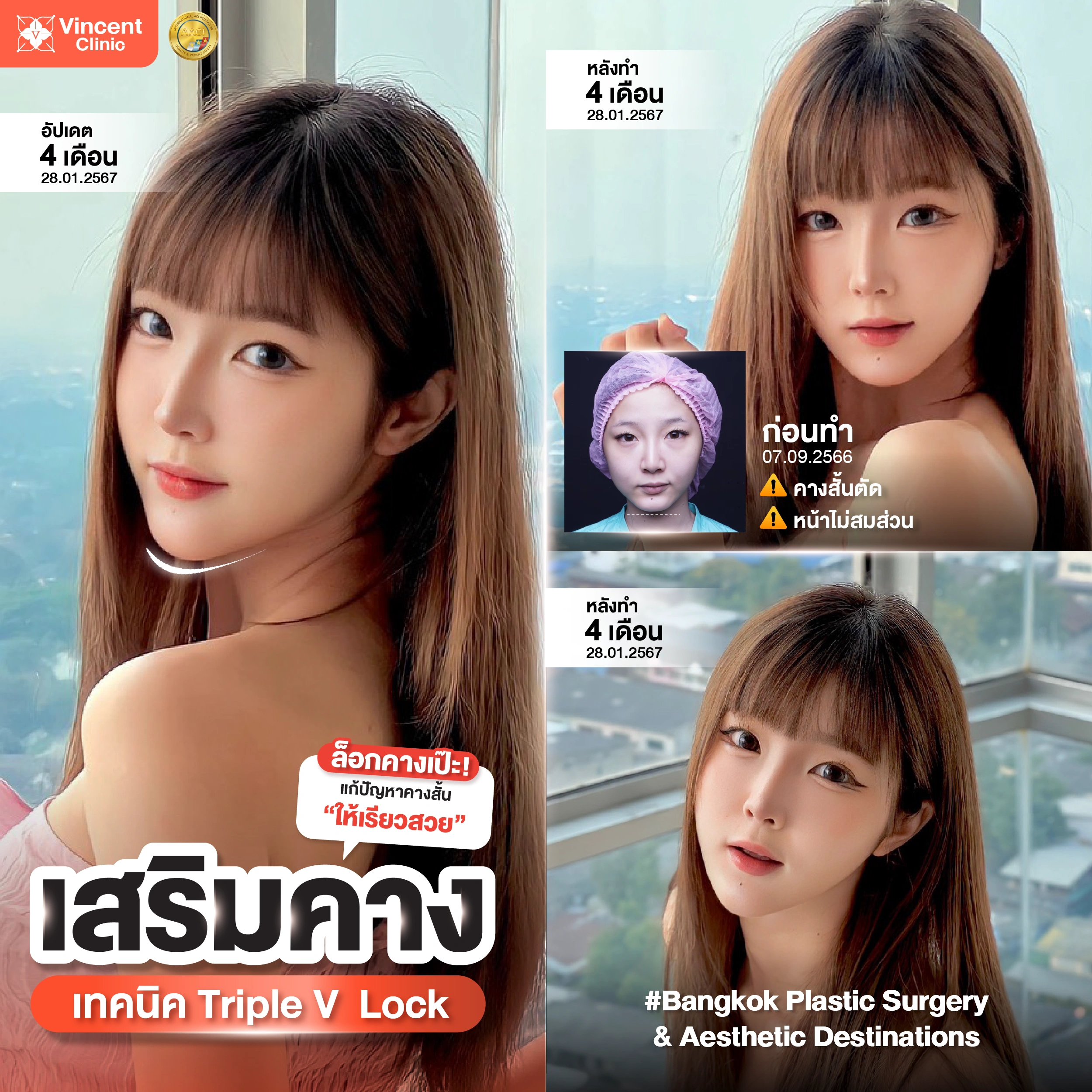 รูปรีวิว