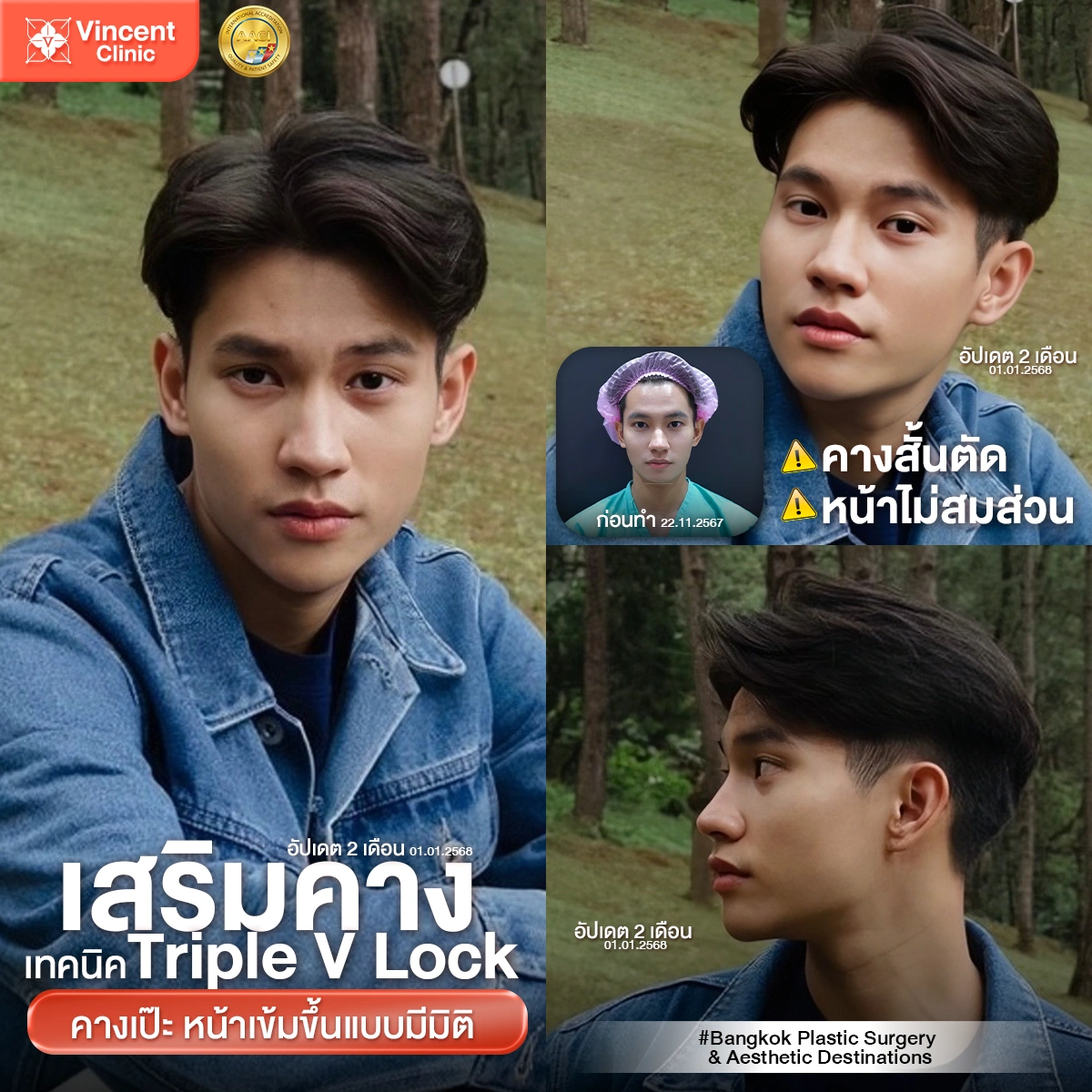 รูปรีวิว