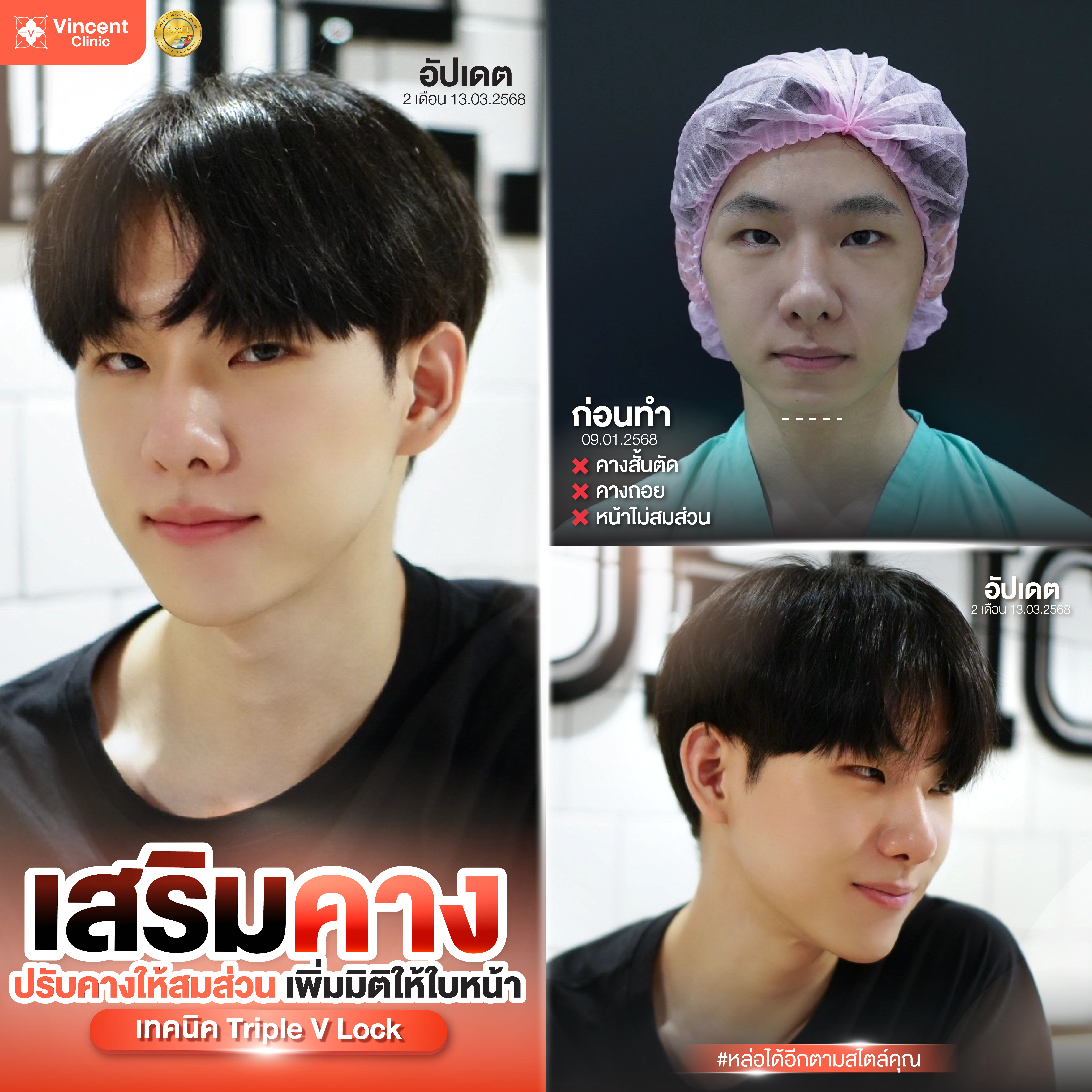 รูปรีวิว