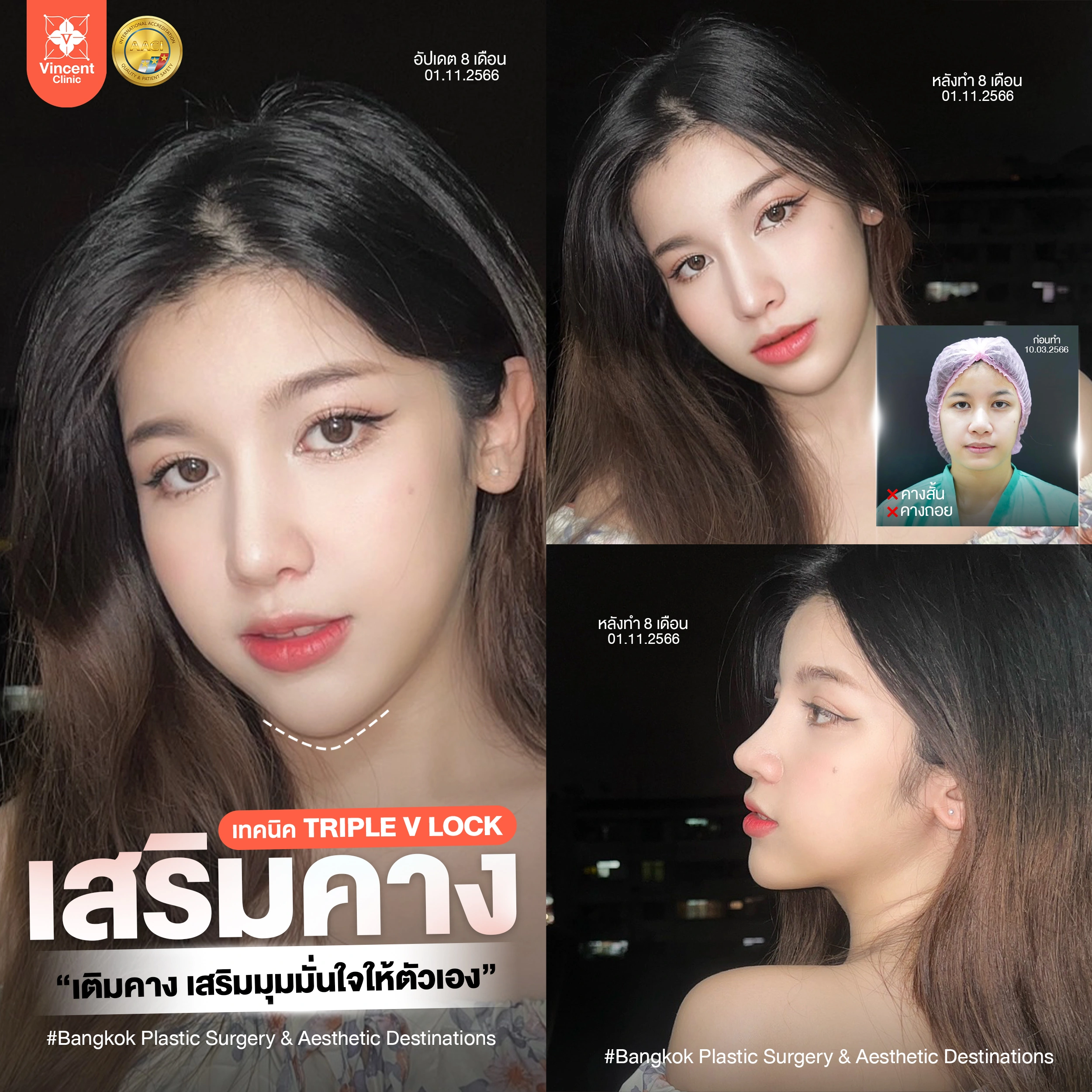 รูปรีวิว