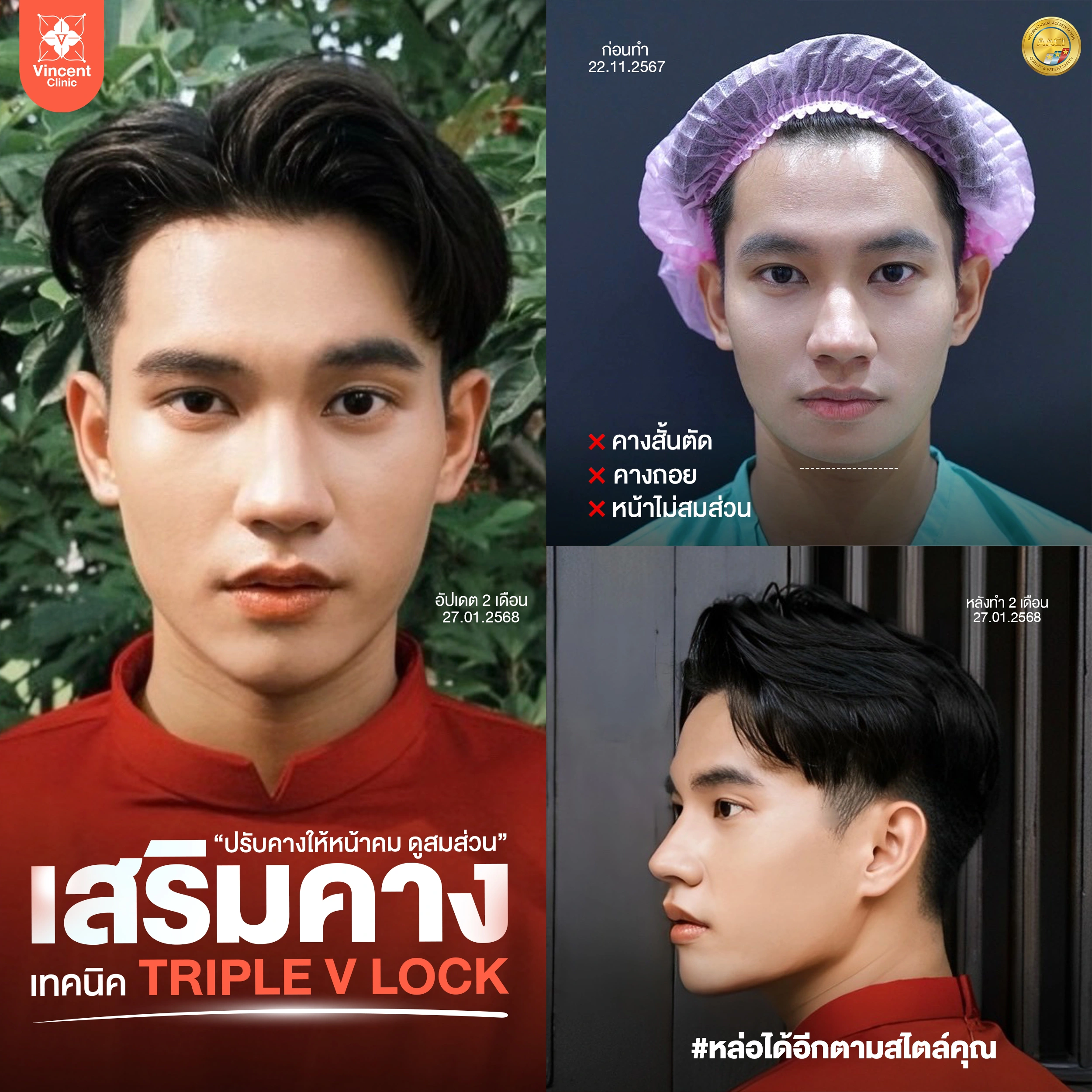 รูปรีวิว