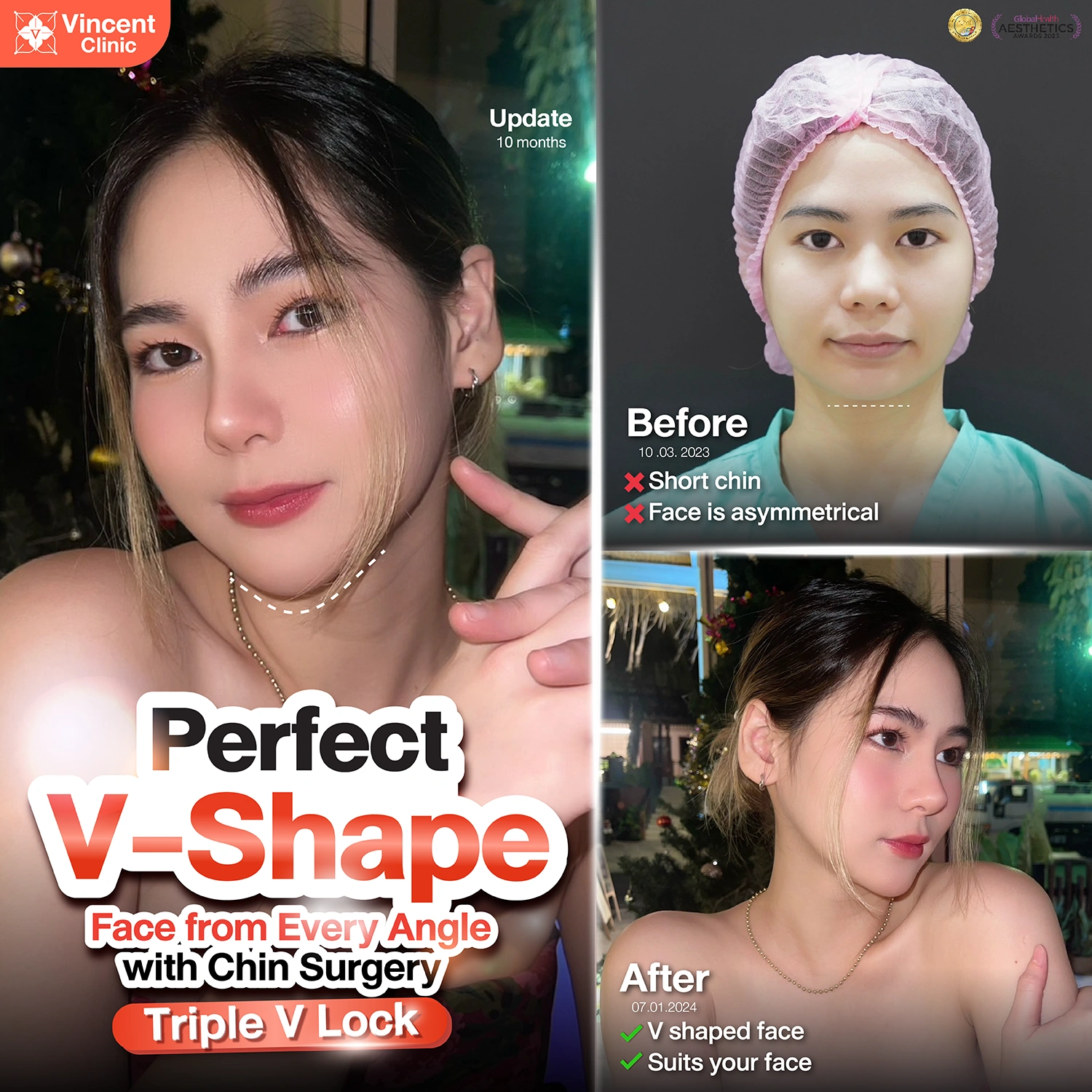 รูปรีวิว
