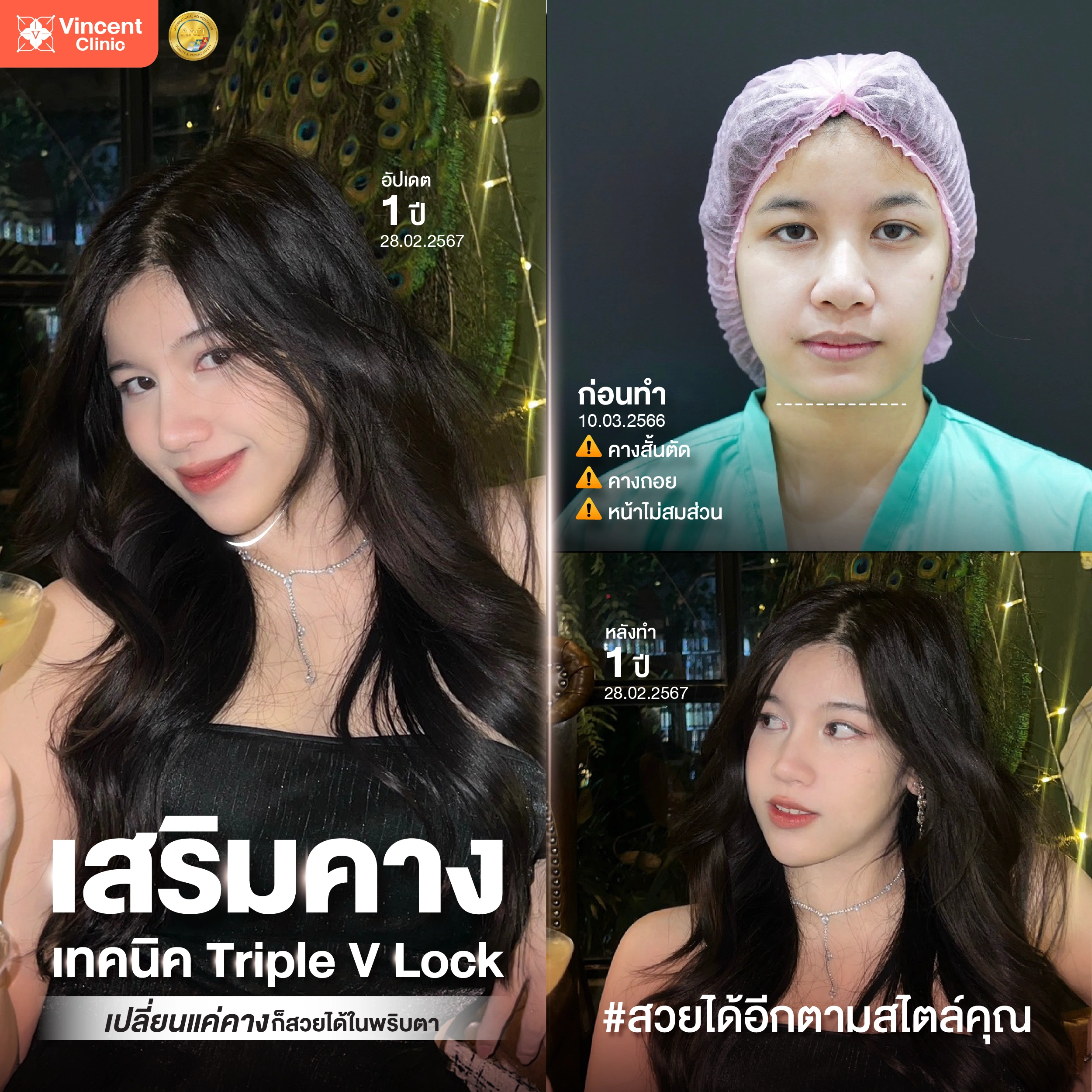 รูปรีวิว