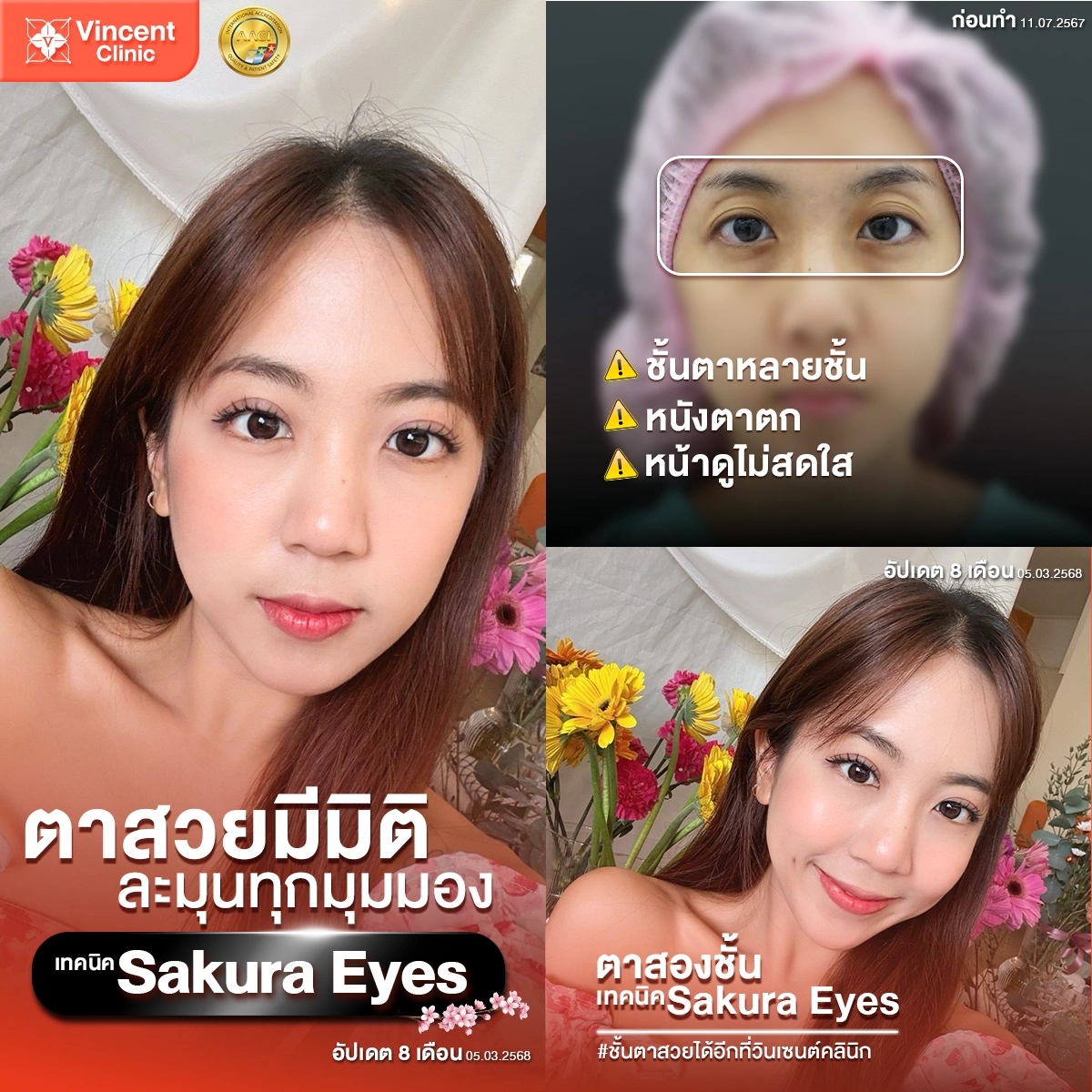 รูปรีวิว