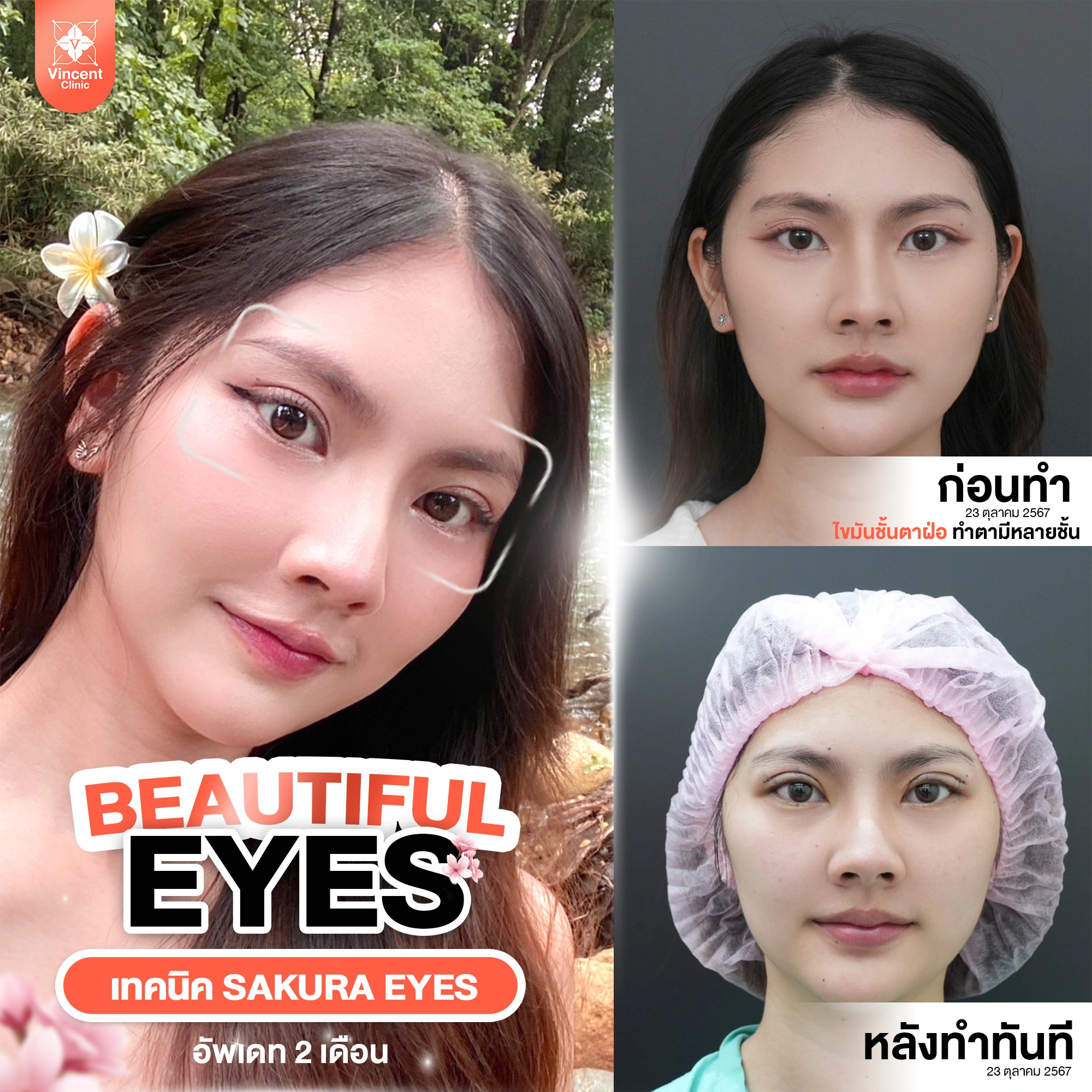 รูปรีวิว