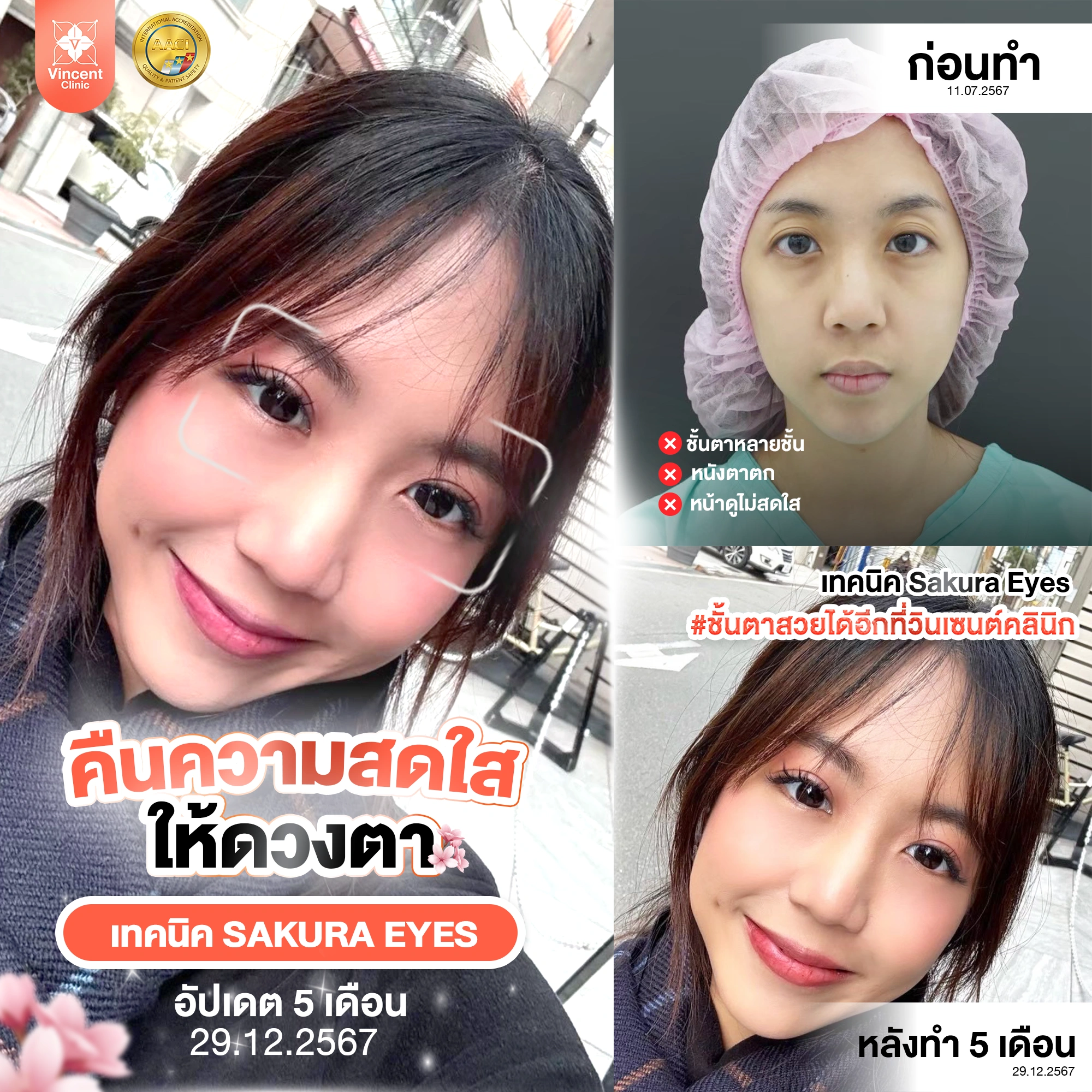 รูปรีวิว