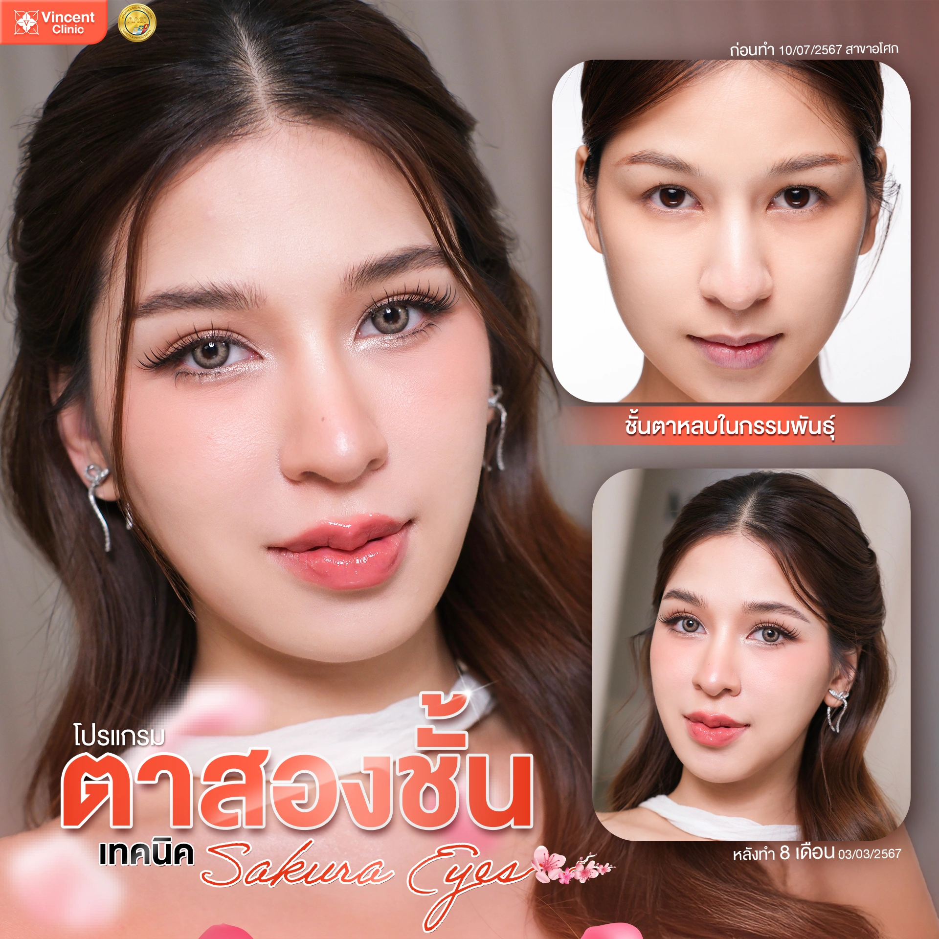 รูปรีวิว