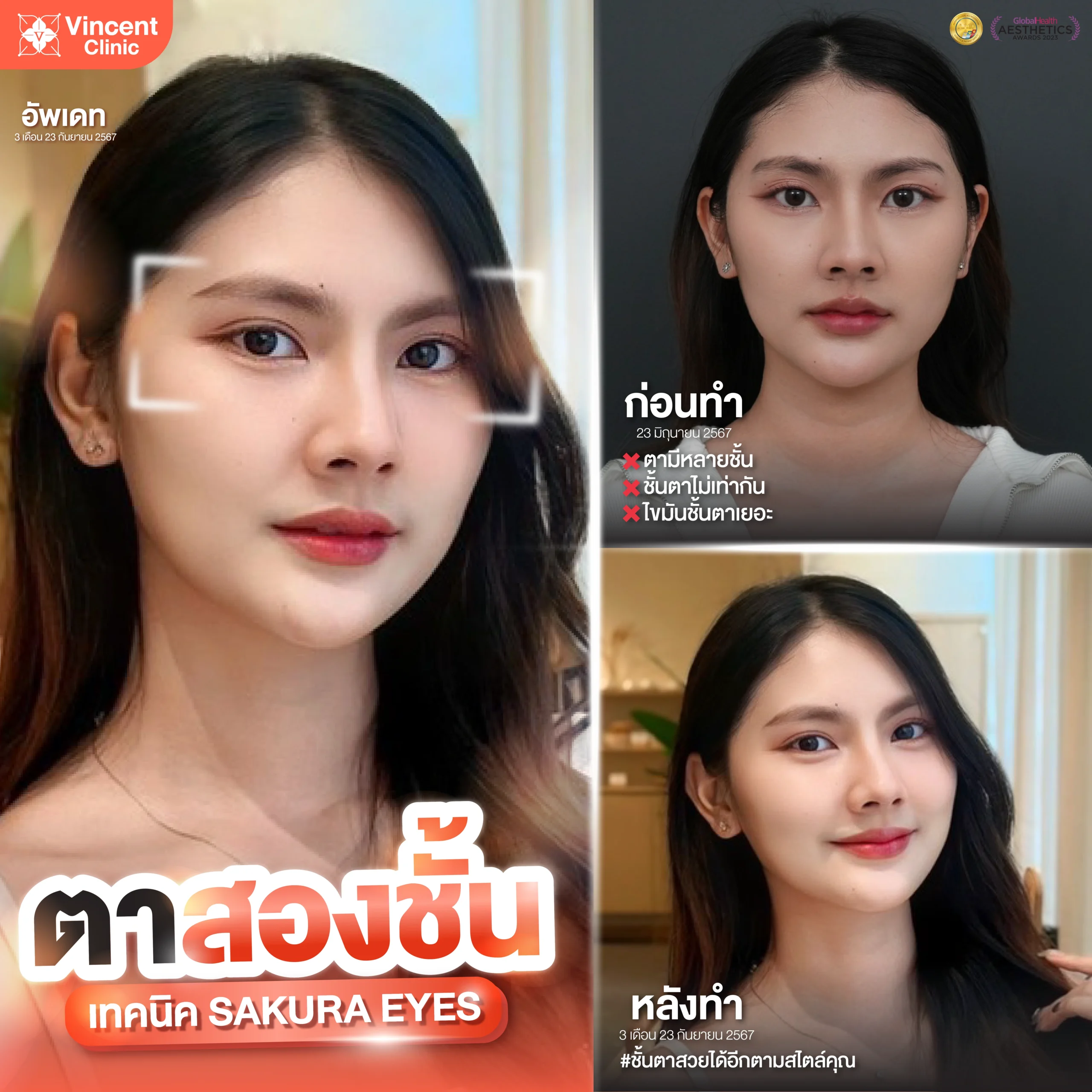 รูปรีวิว