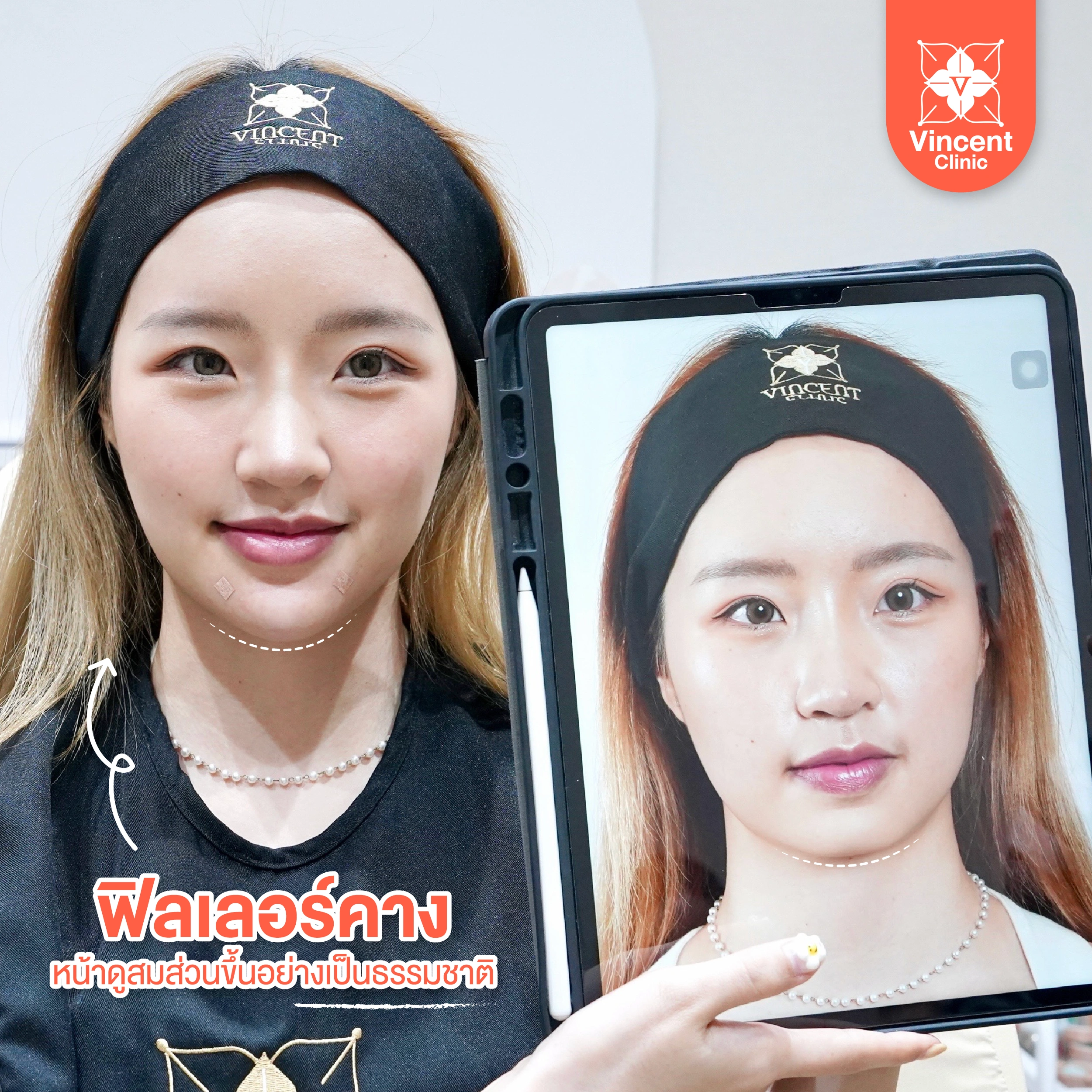 รูปรีวิว