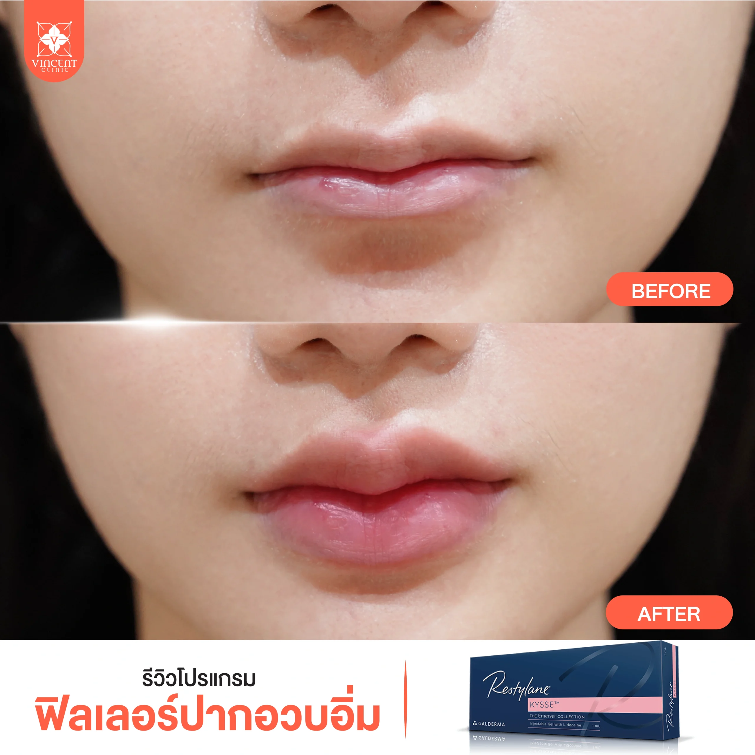 รูปรีวิว