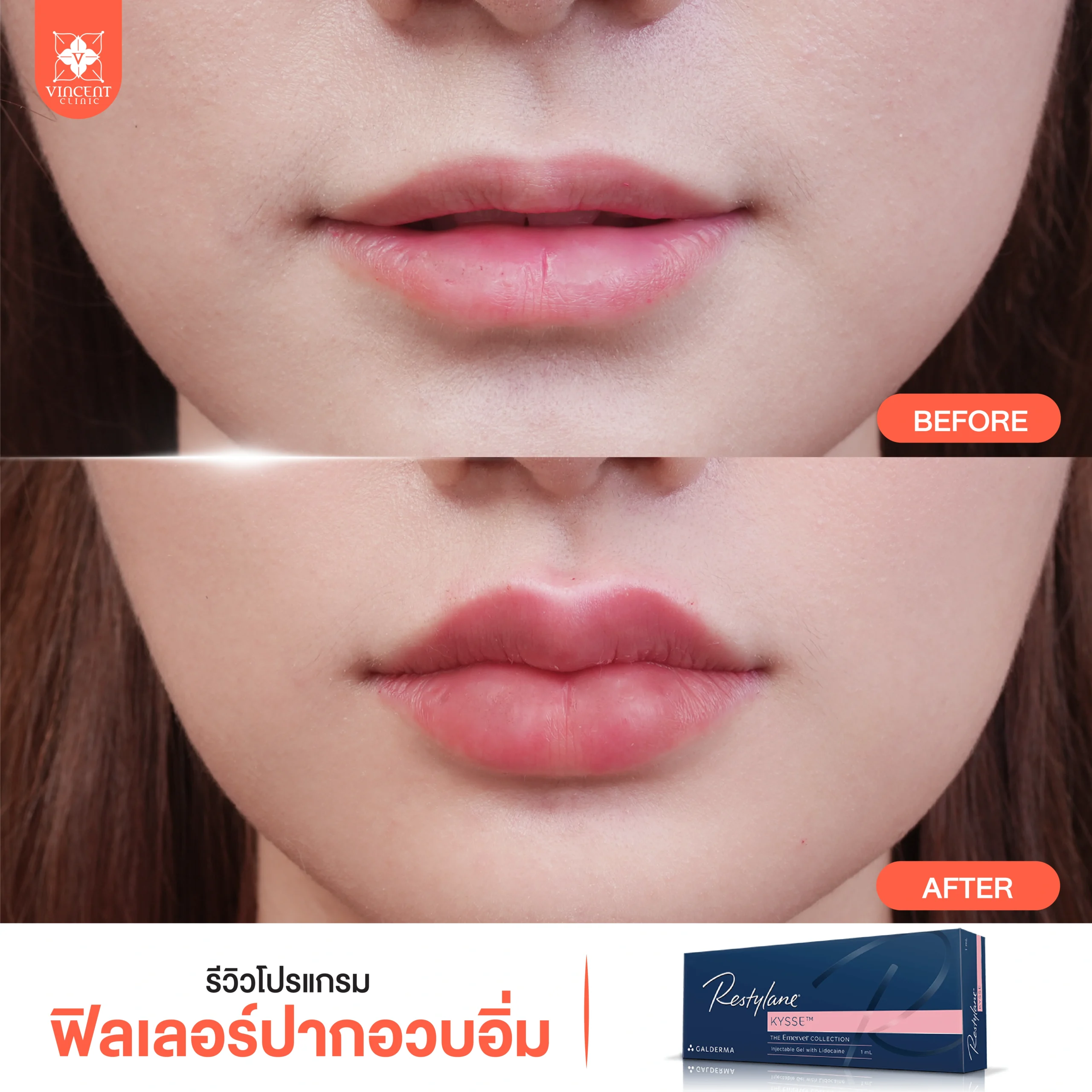 รูปรีวิว