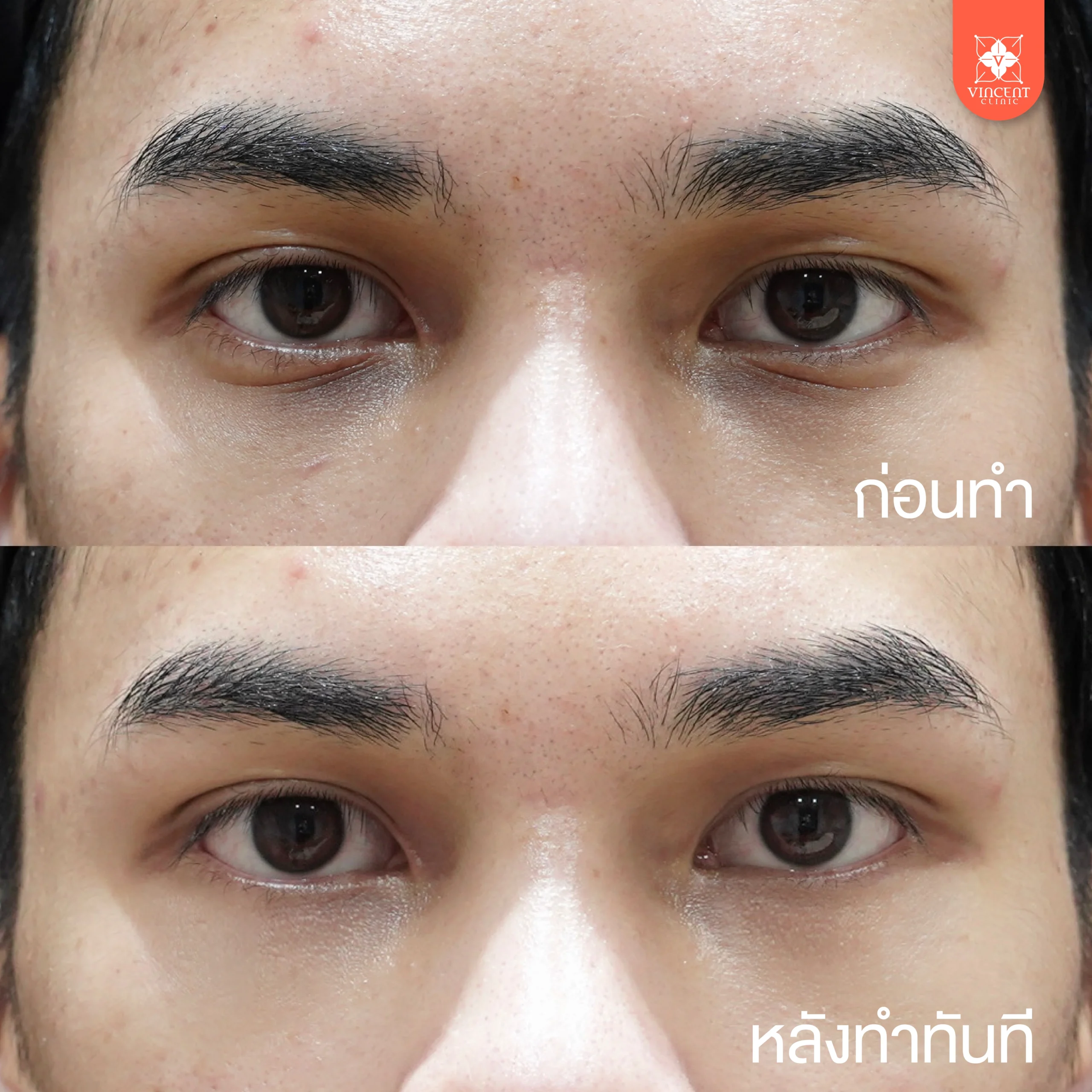 รูปรีวิว