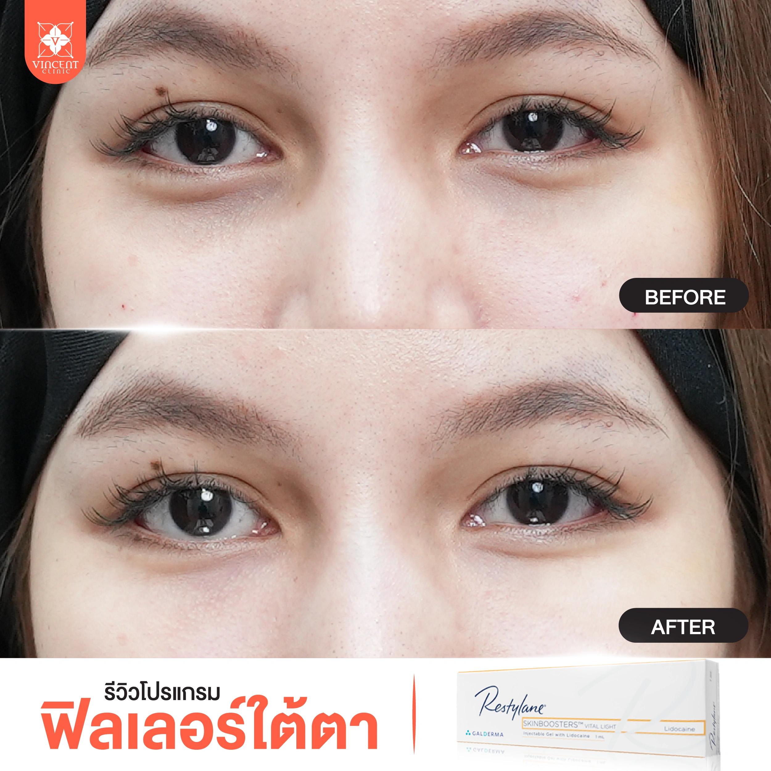 รูปรีวิว