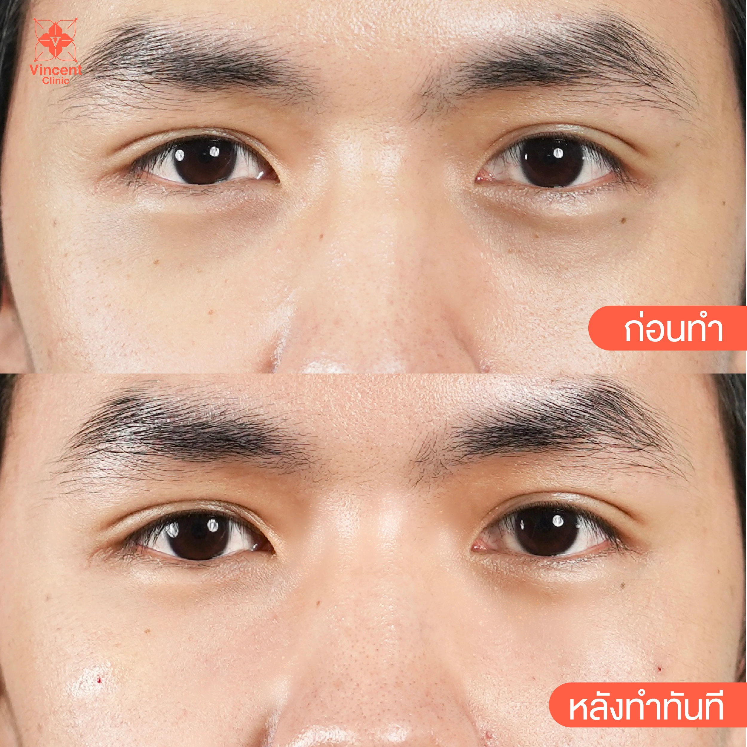 รูปรีวิว