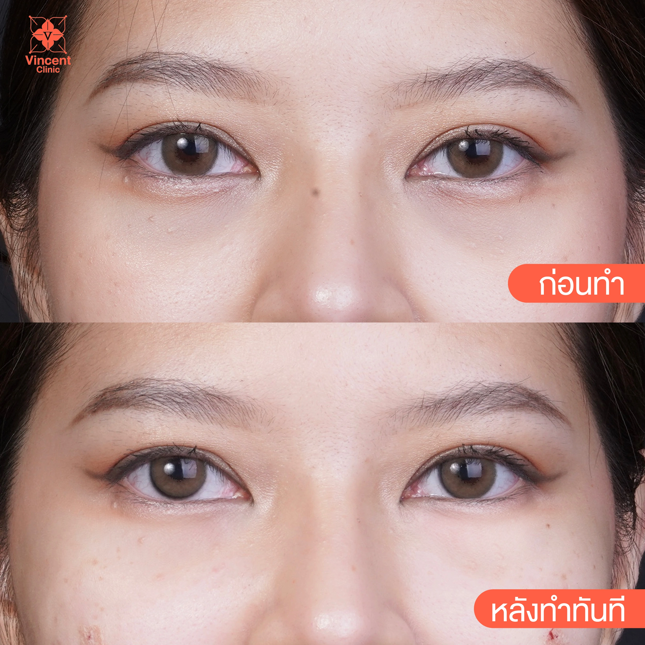 รูปรีวิว