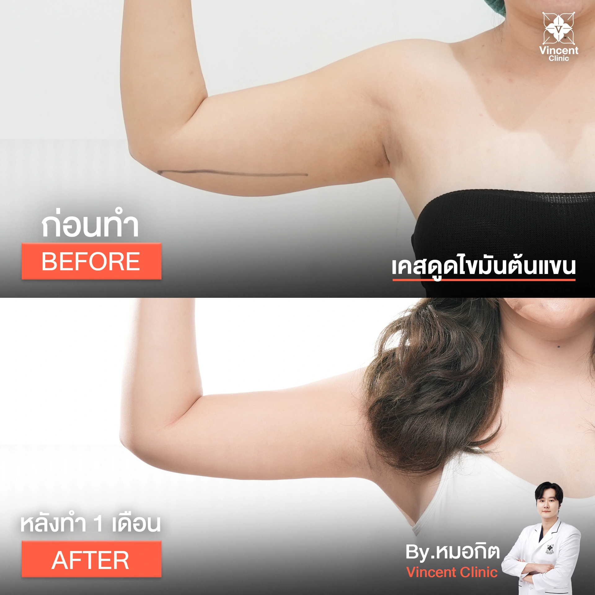 รูปรีวิว
