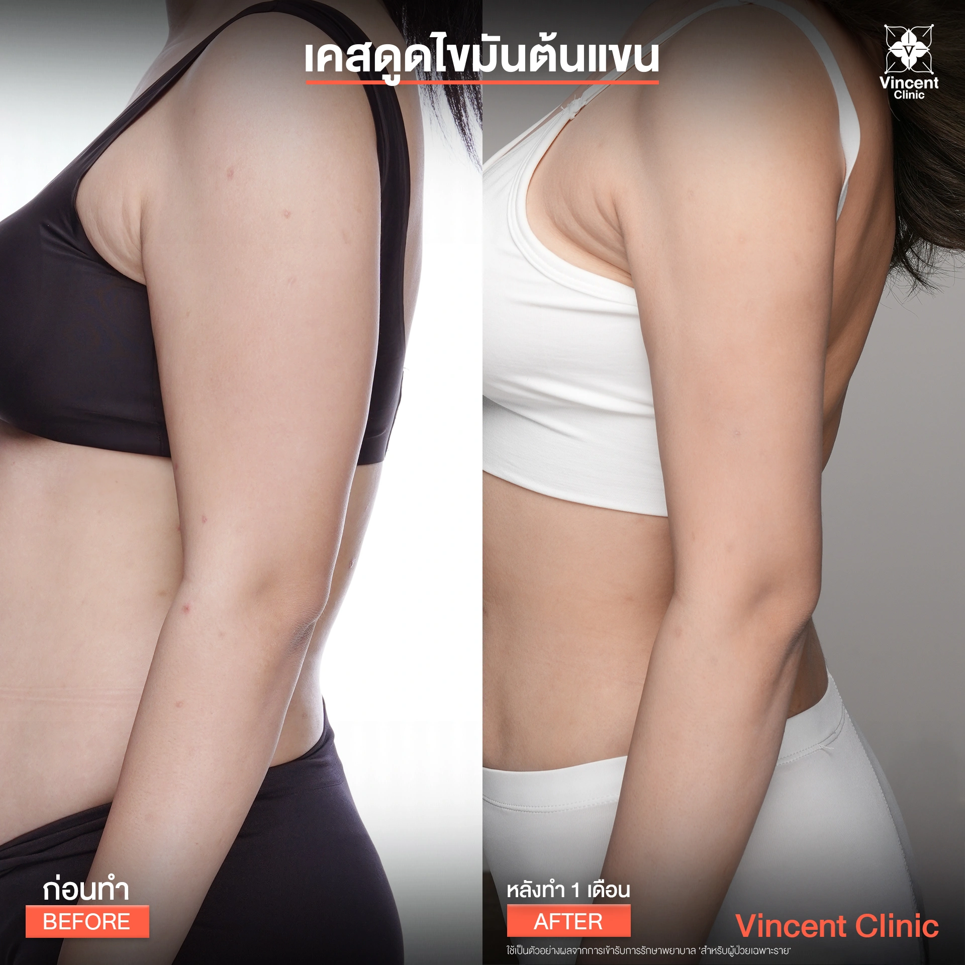 รูปรีวิว