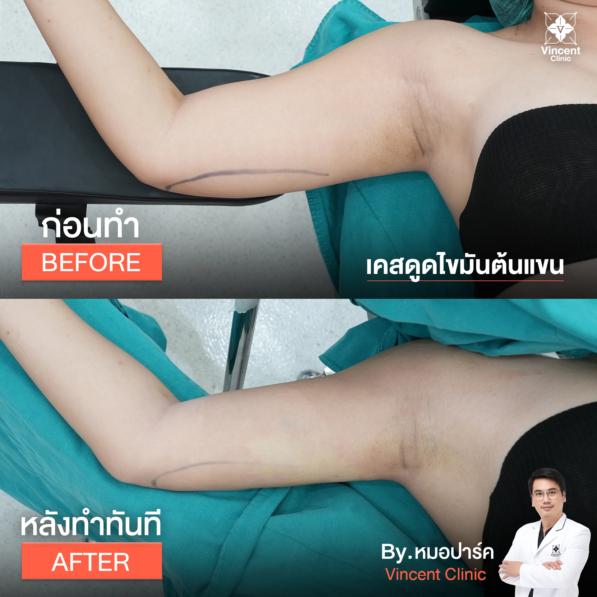 รูปรีวิว