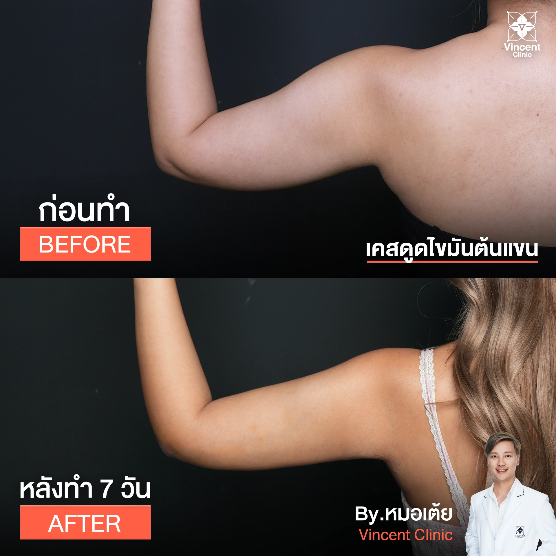 รูปรีวิว