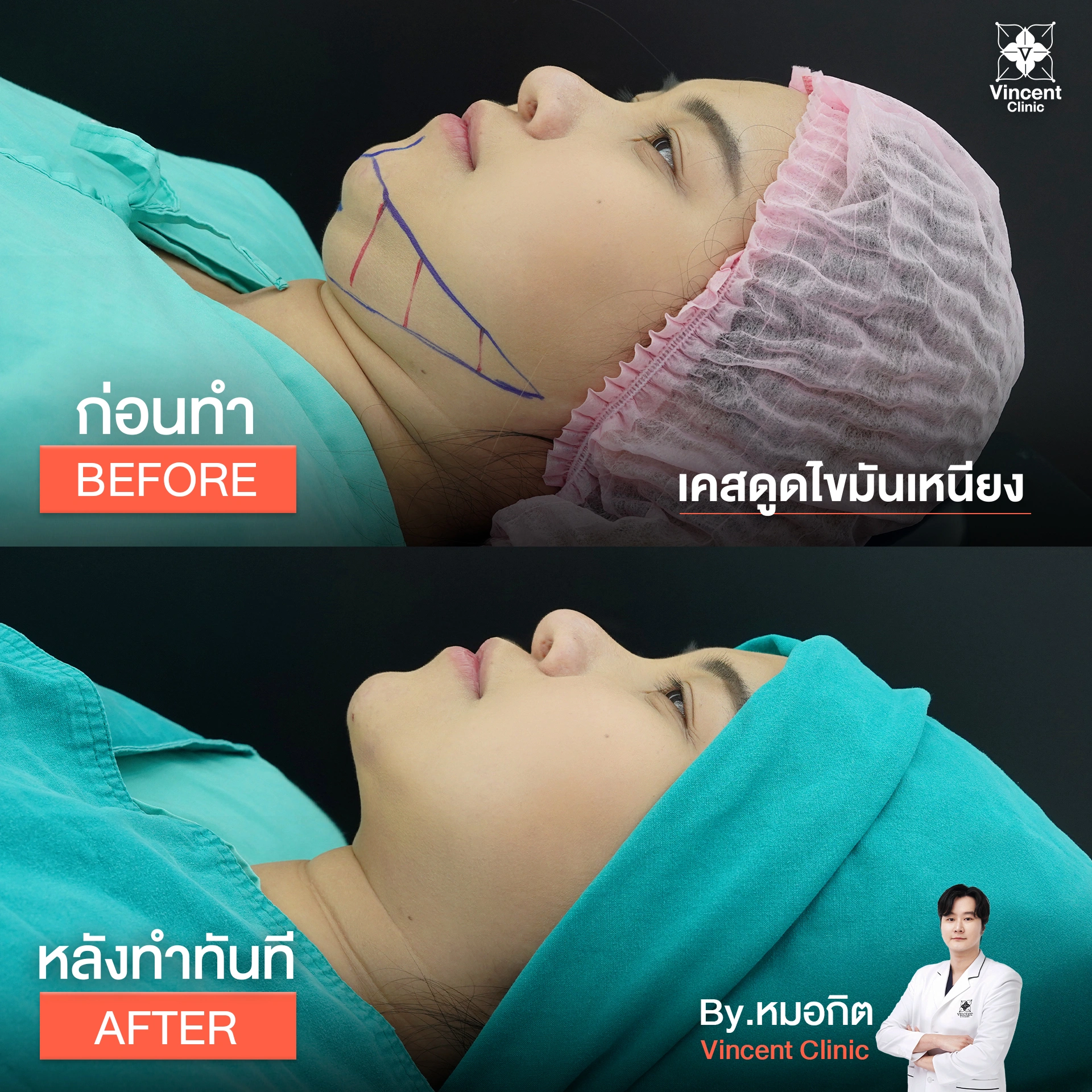 รูปรีวิว