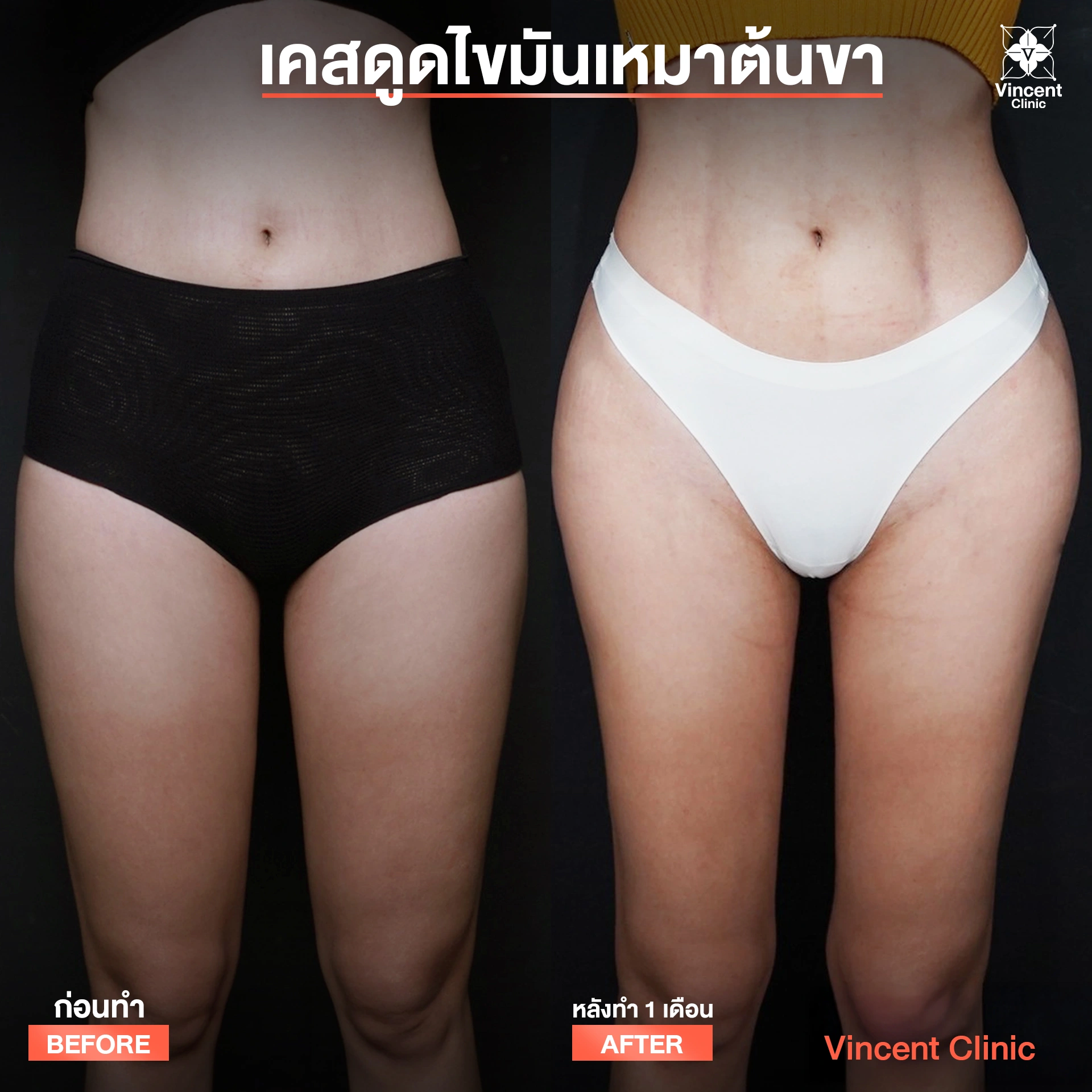 รูปรีวิว