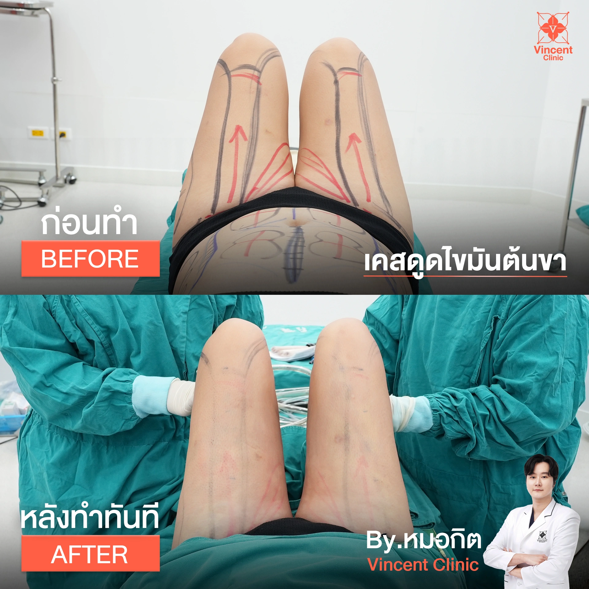 รูปรีวิว