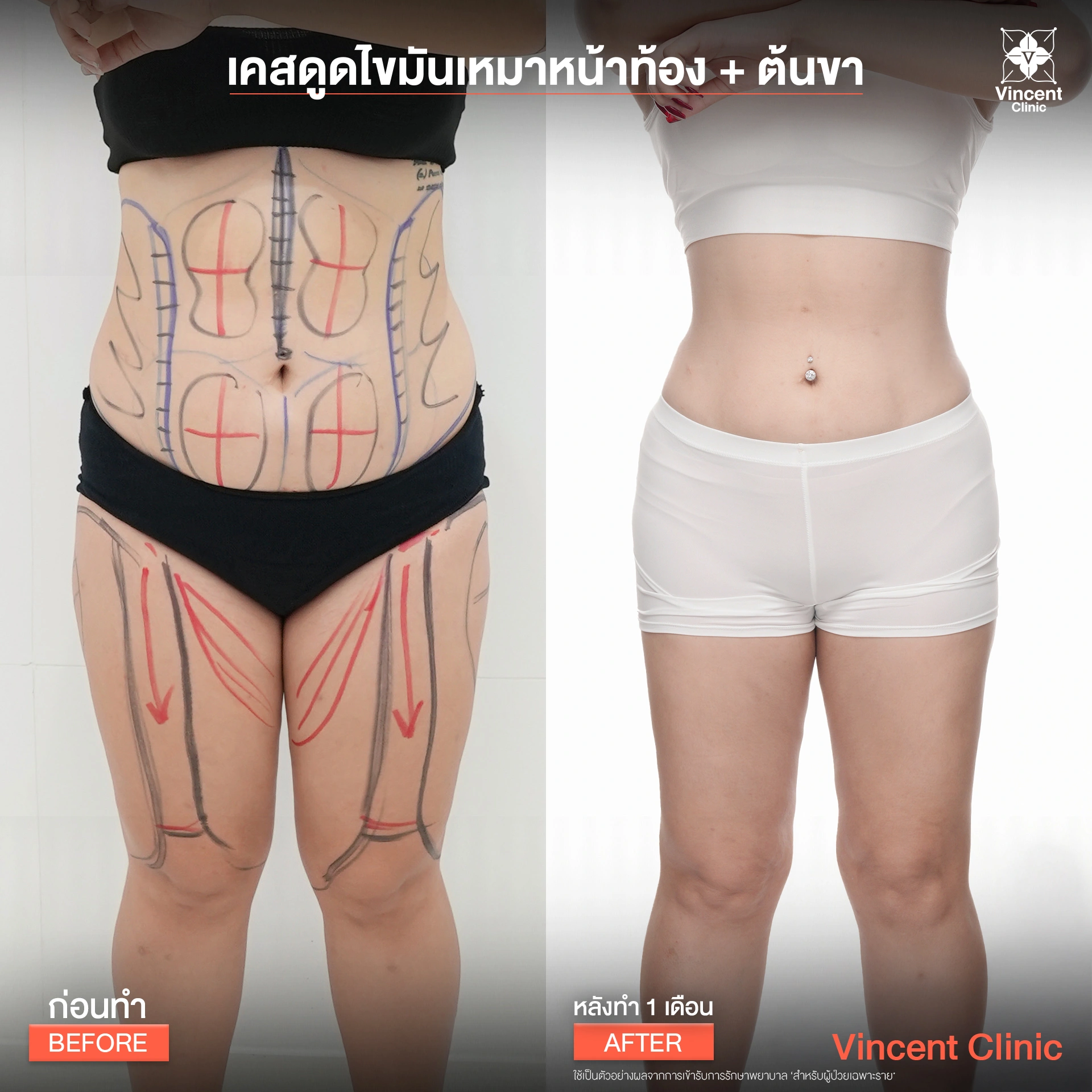 รูปรีวิว