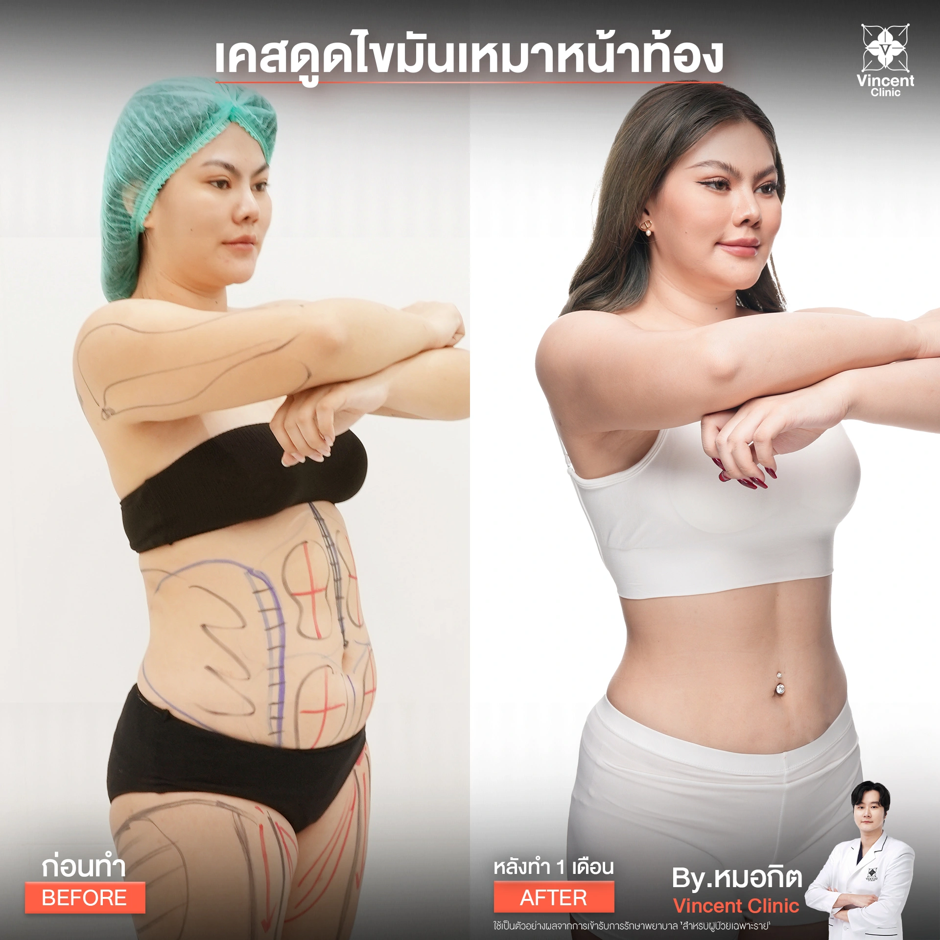 รูปรีวิว