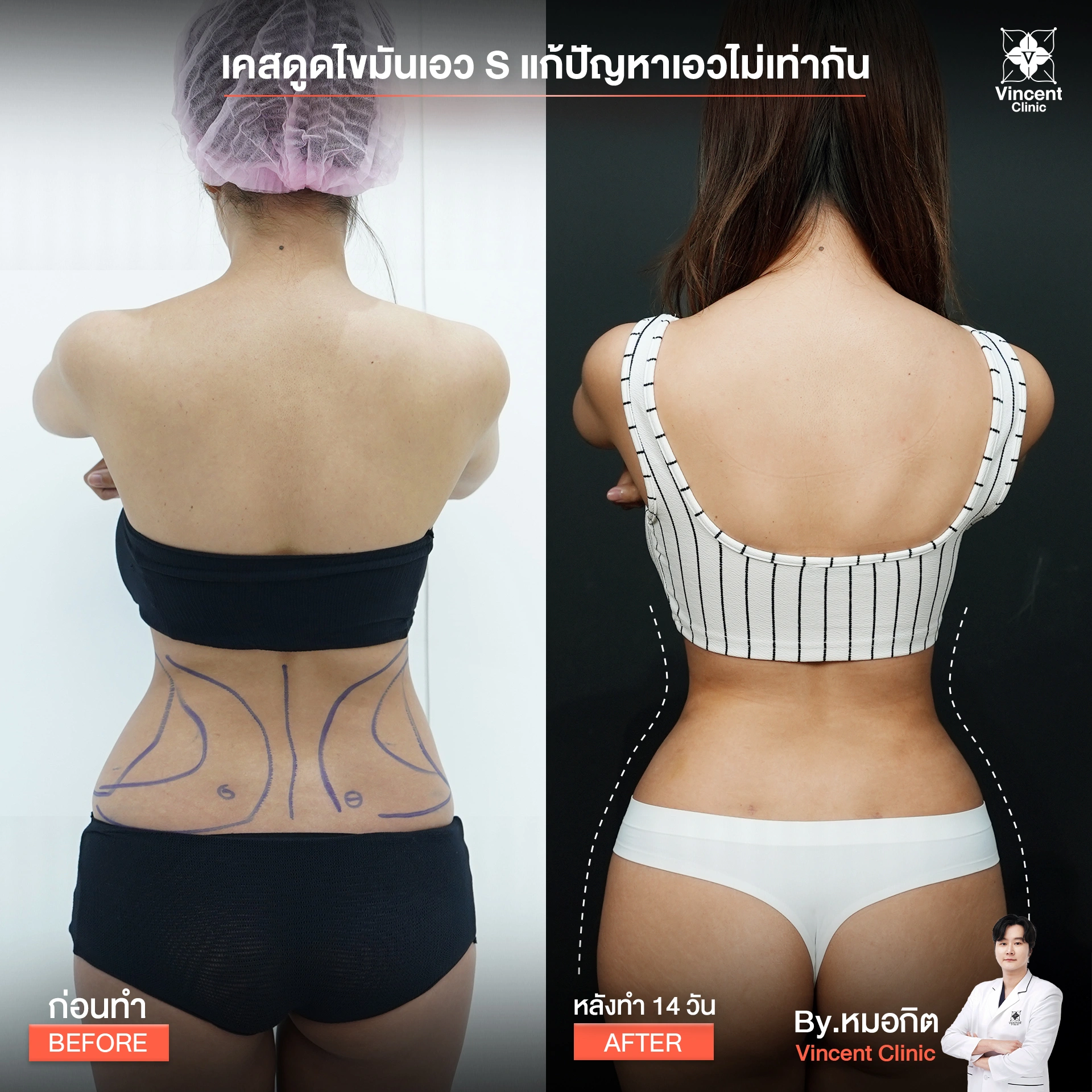 รูปรีวิว