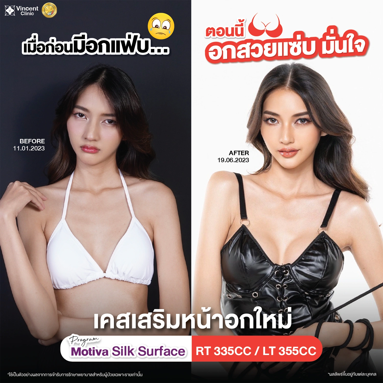 รูปรีวิว