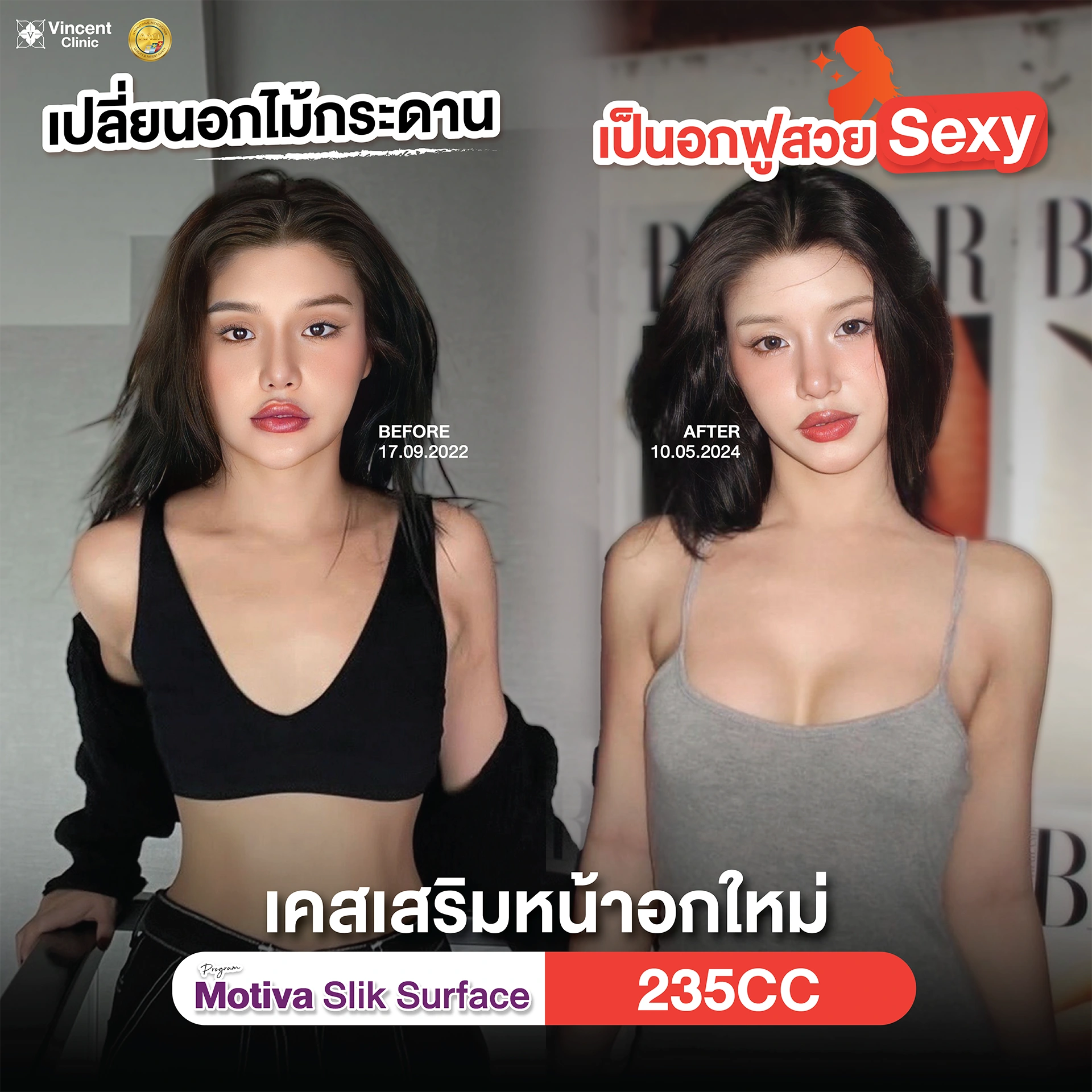 รูปรีวิว