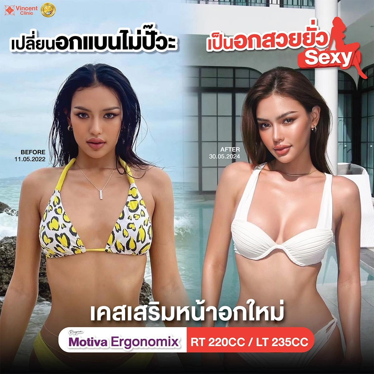 รูปรีวิว