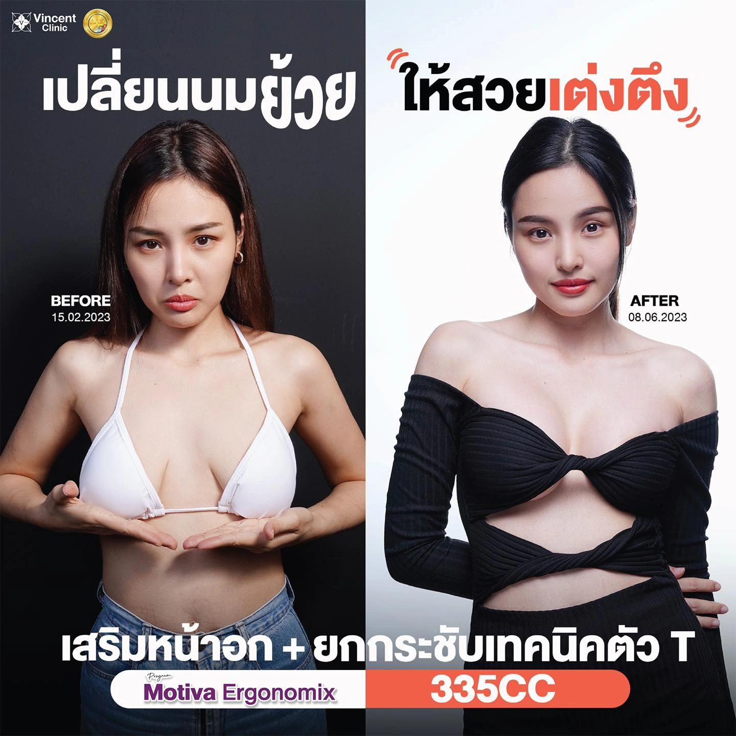 รูปรีวิว
