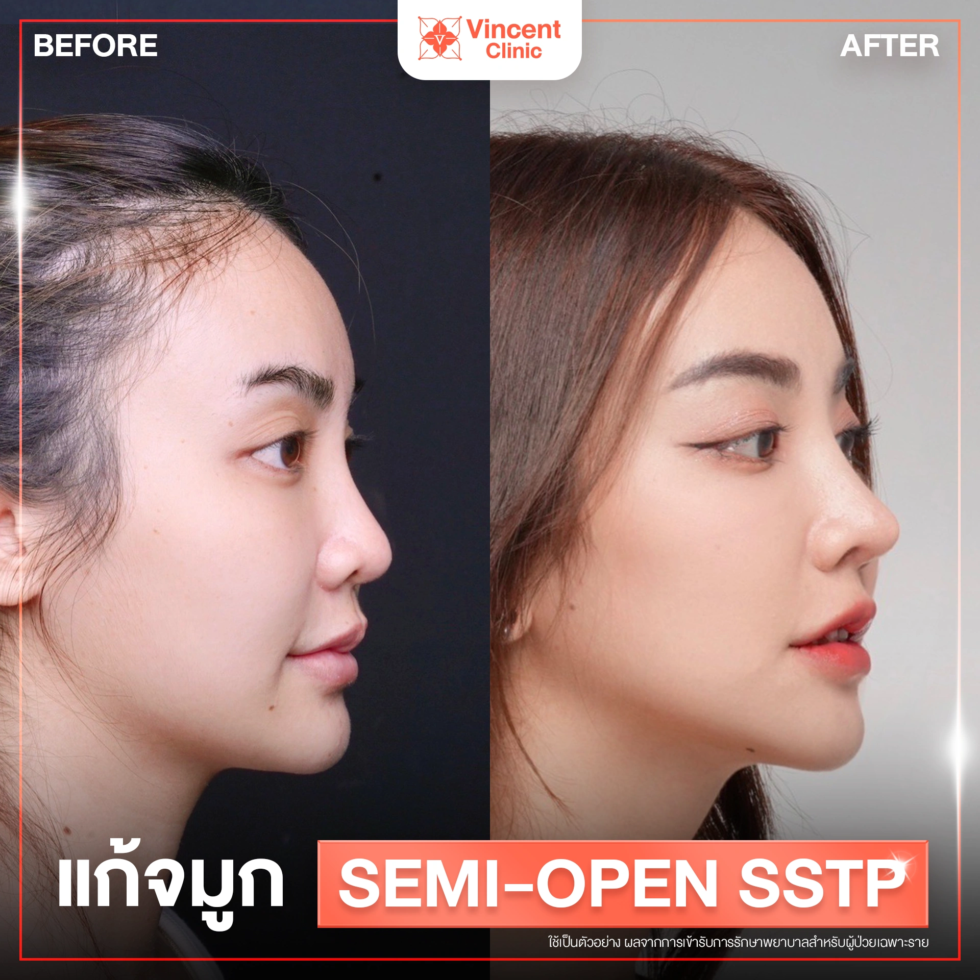 รูปรีวิว
