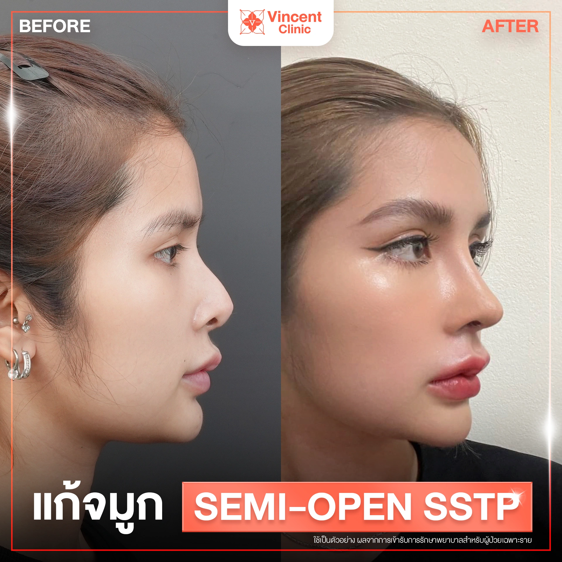 รูปรีวิว