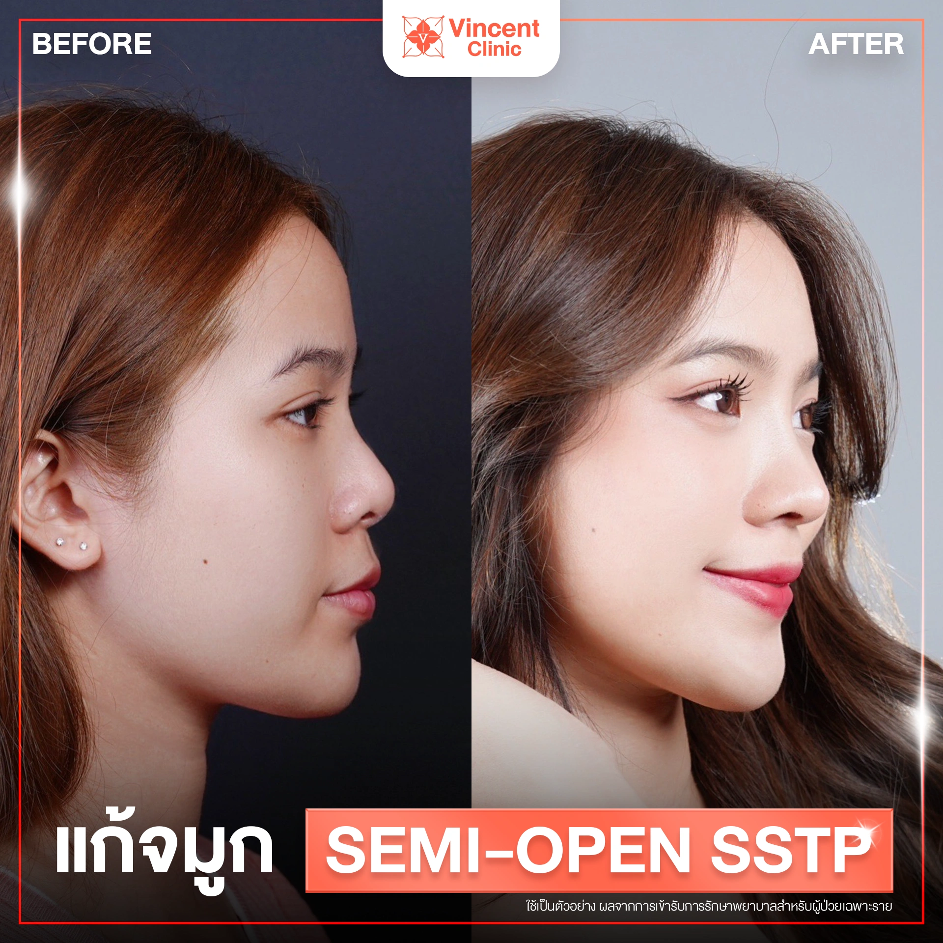 รูปรีวิว