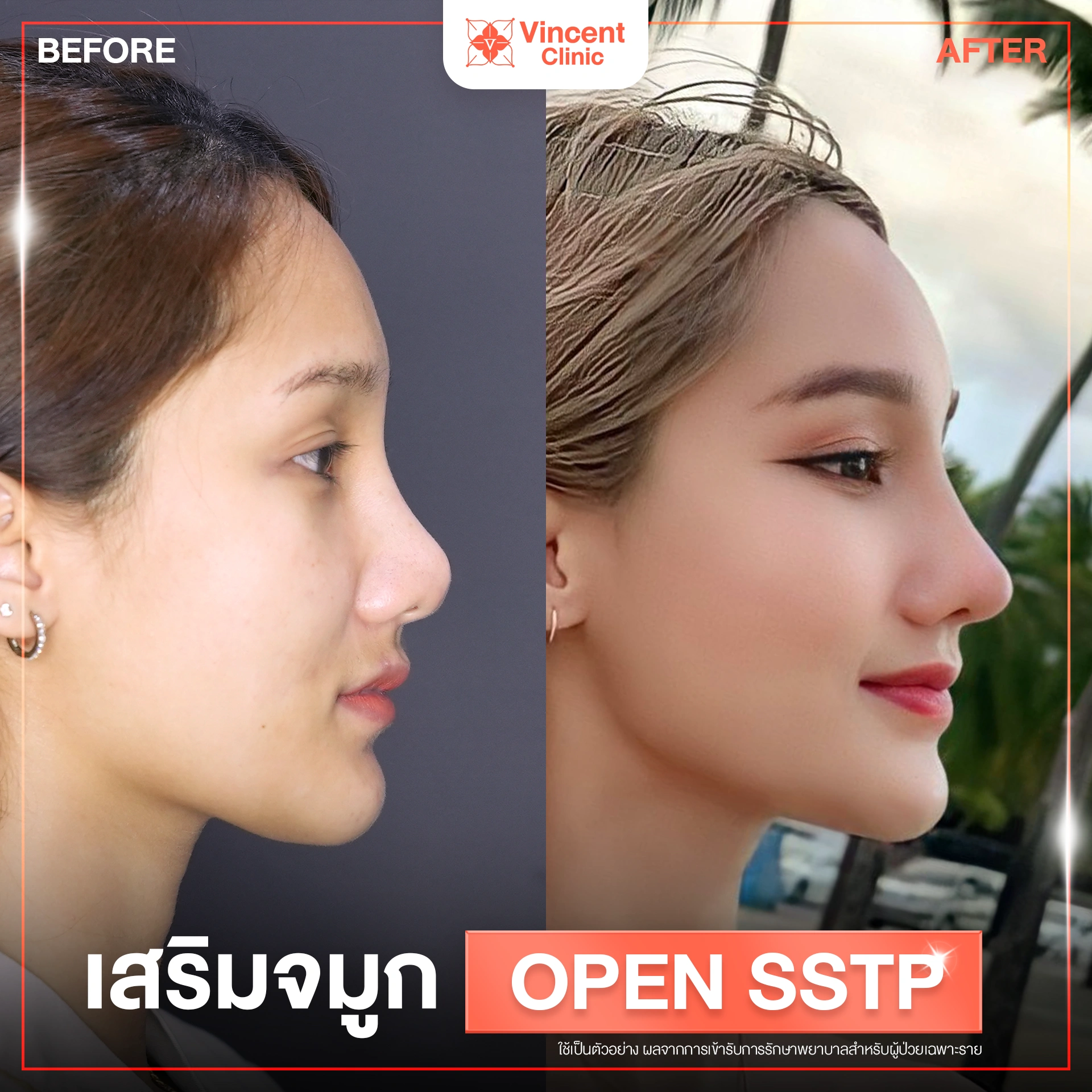 รูปรีวิว