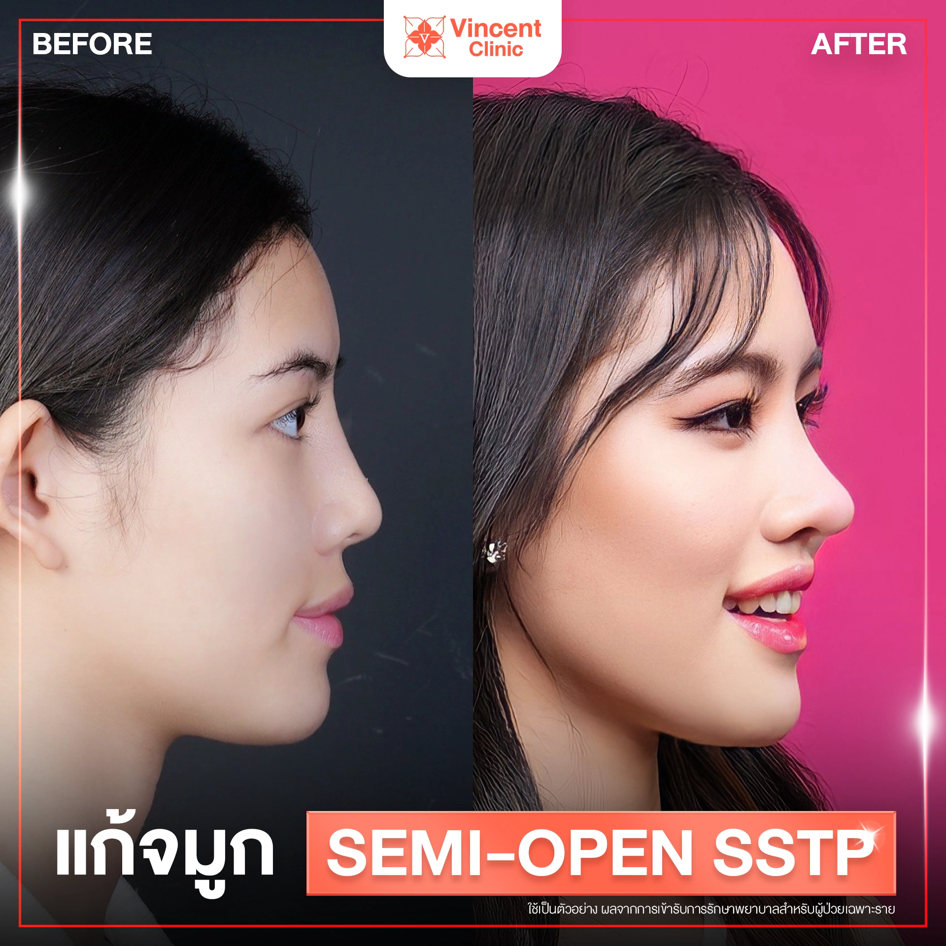รูปรีวิว