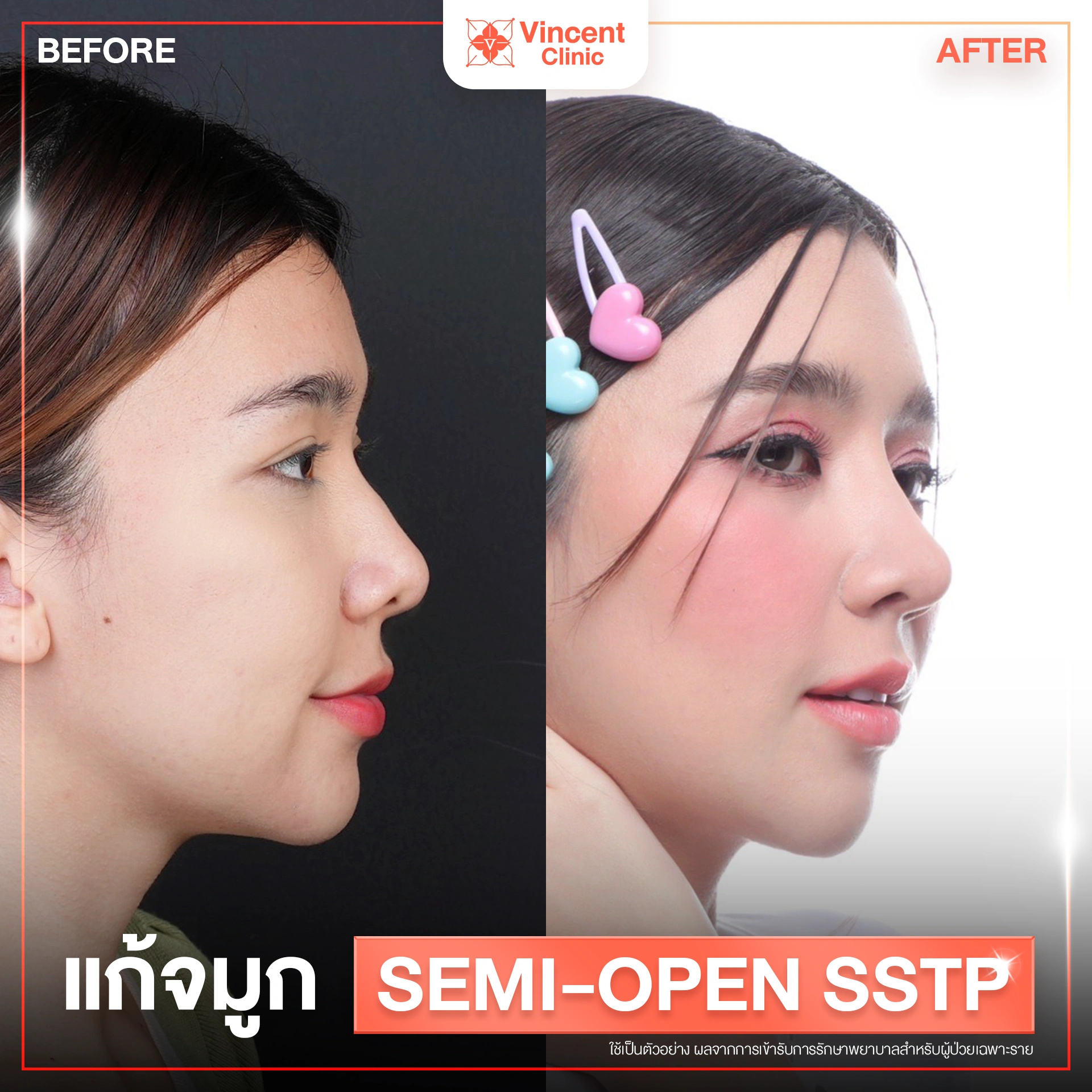 รูปรีวิว