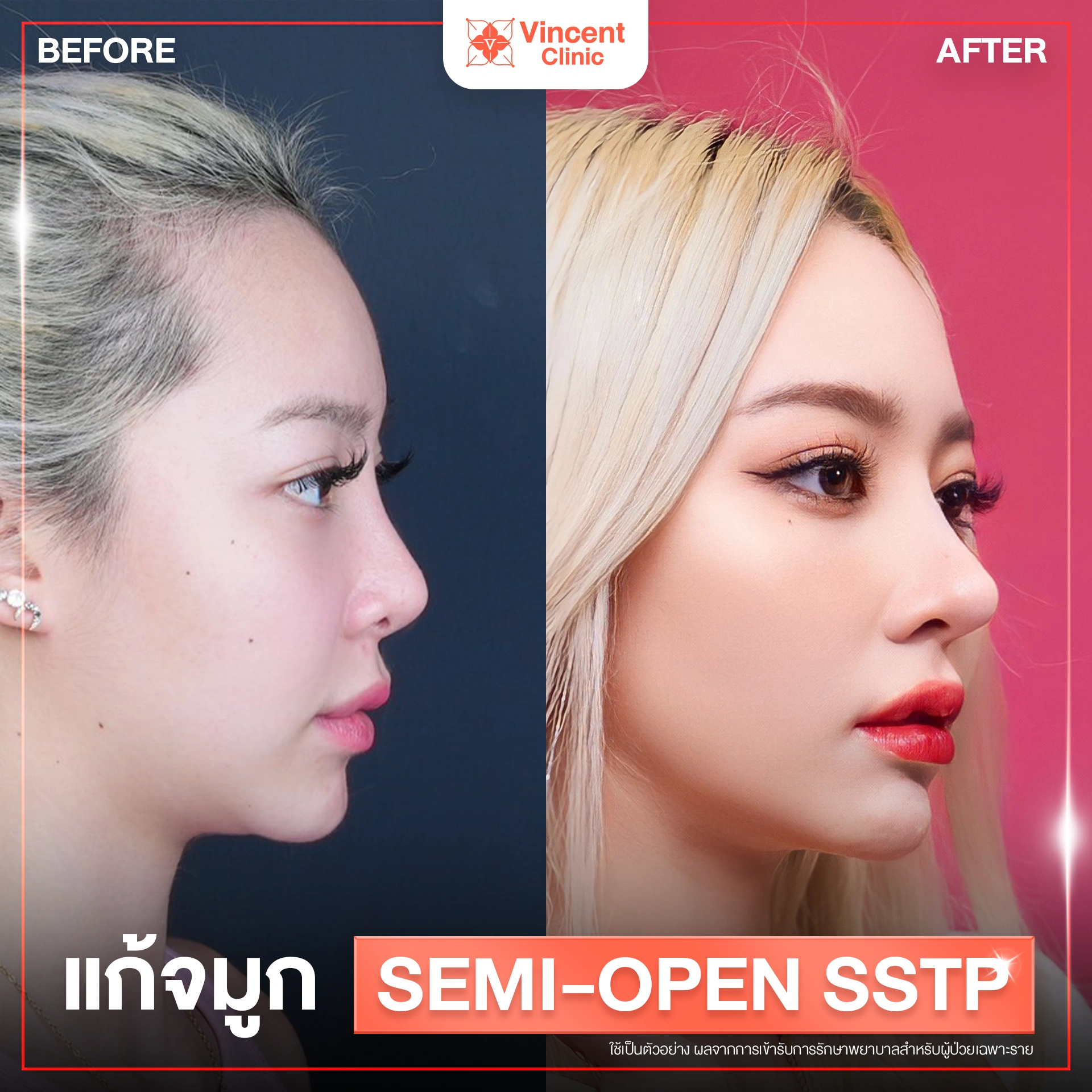รูปรีวิว